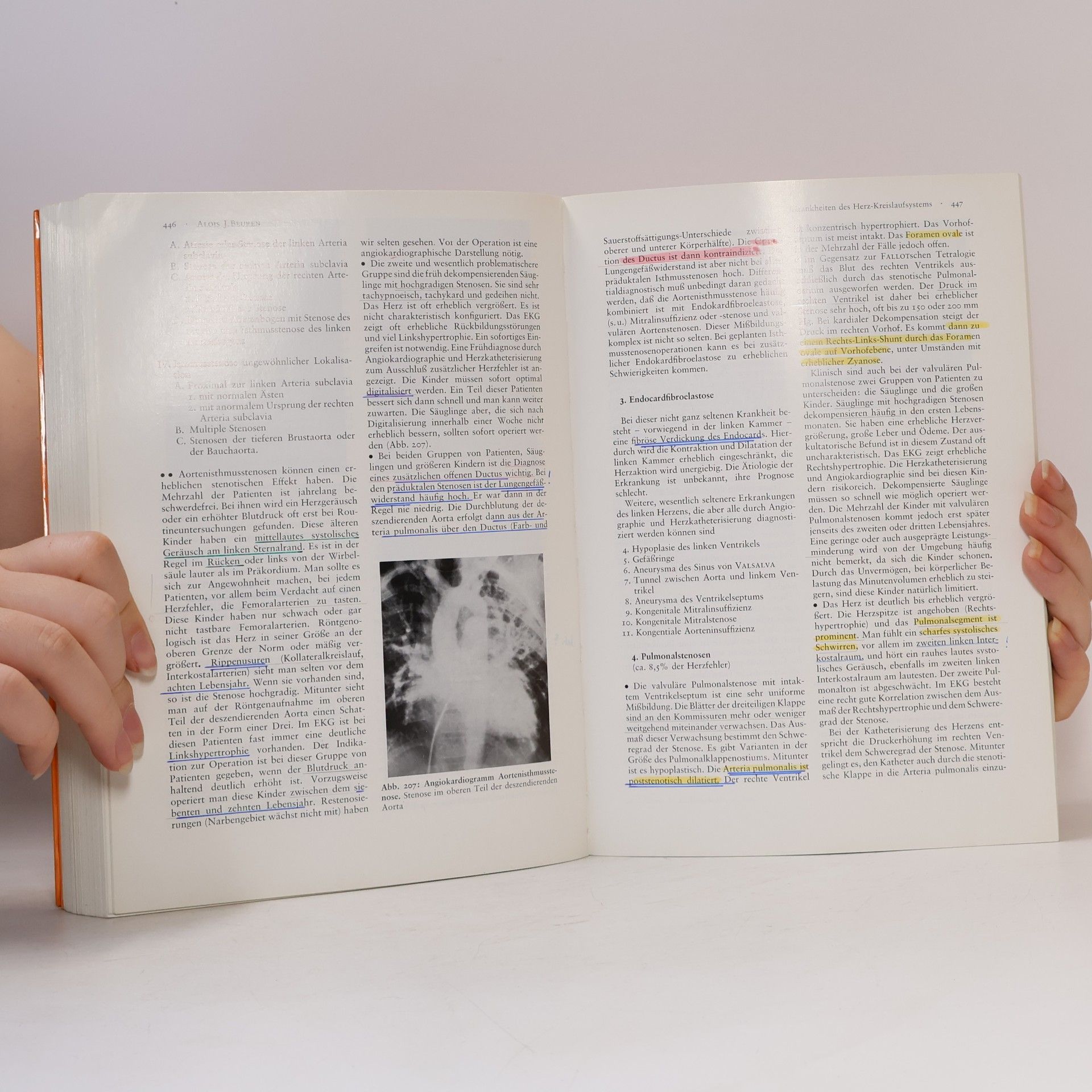 Emil Feer Lehrbuch der Kinderheilkunde