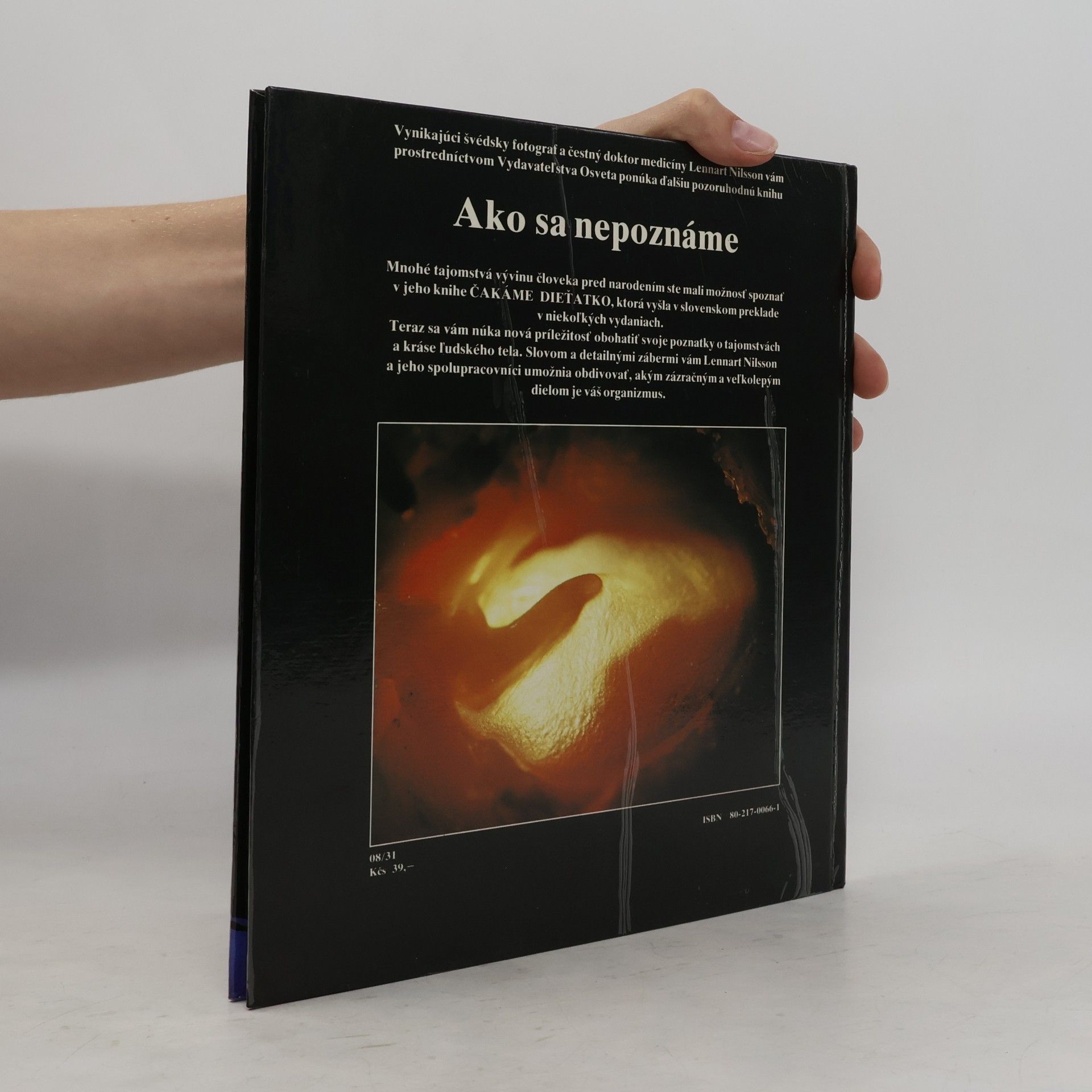 Various authors Ako sa nepoznáme: Objavná cesta s fotografickým aparátom do nášho tela