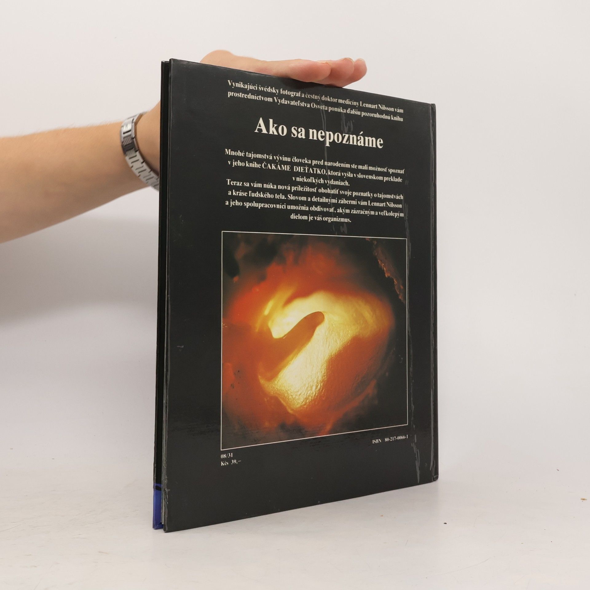 Various authors Ako sa nepoznáme: Objavná cesta s fotografickým aparátom do nášho tela