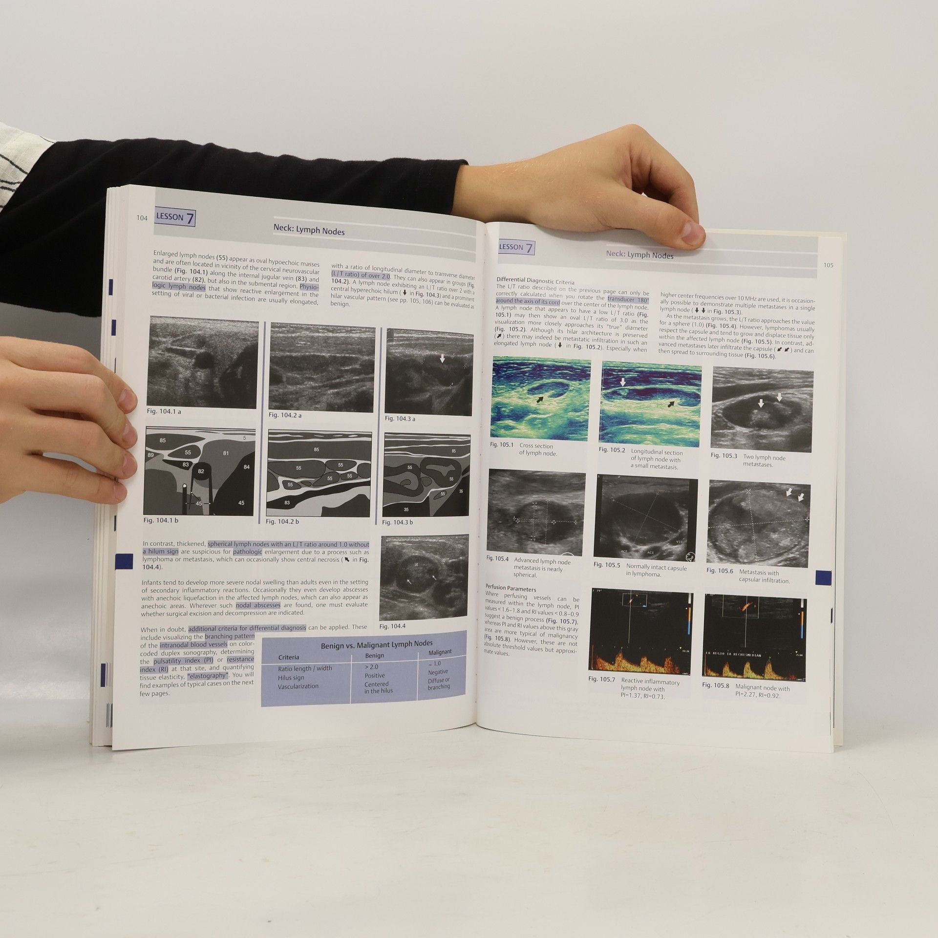 Matthias Hofer Ultrasound Teaching Manual - 3rd Edition