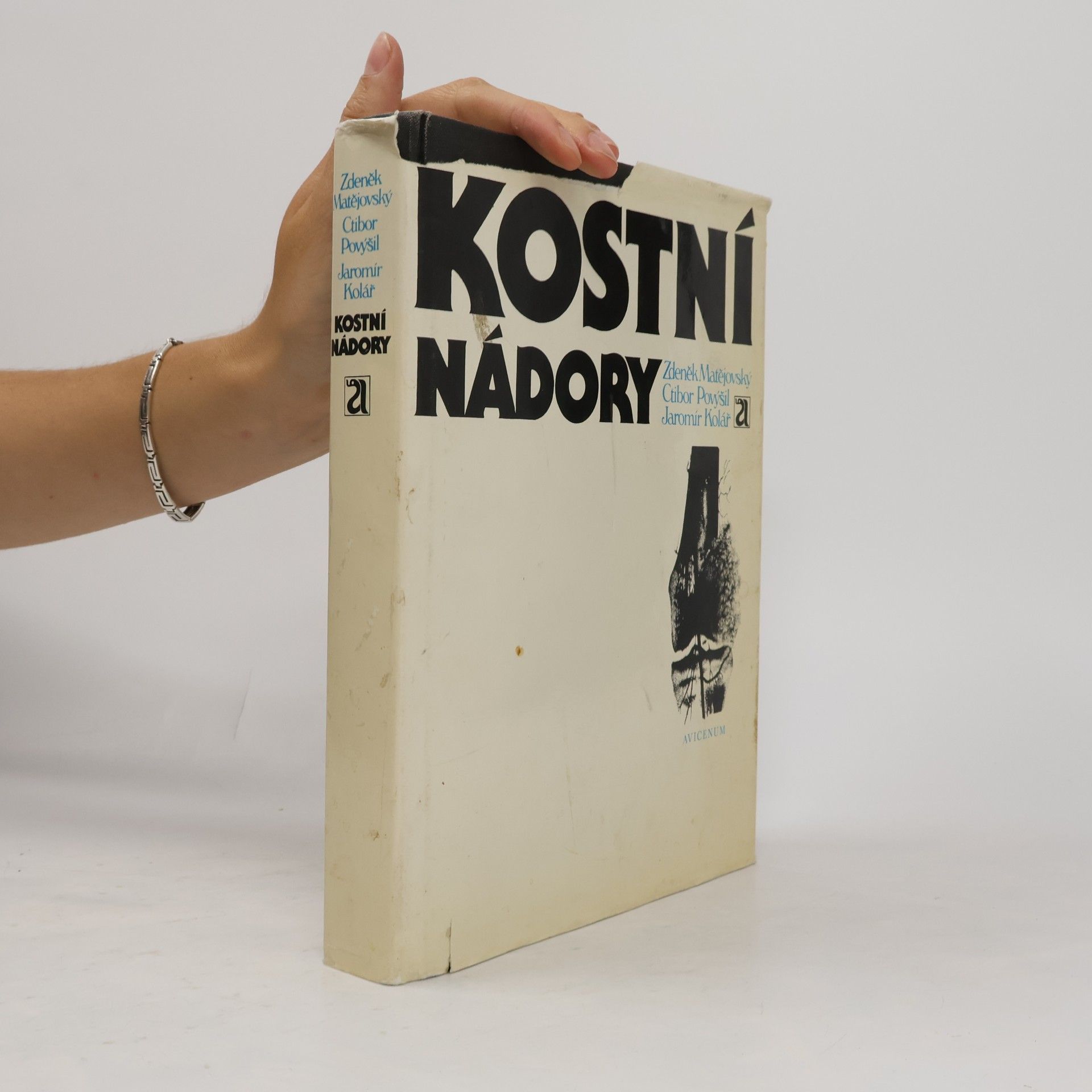 Kostní nádory