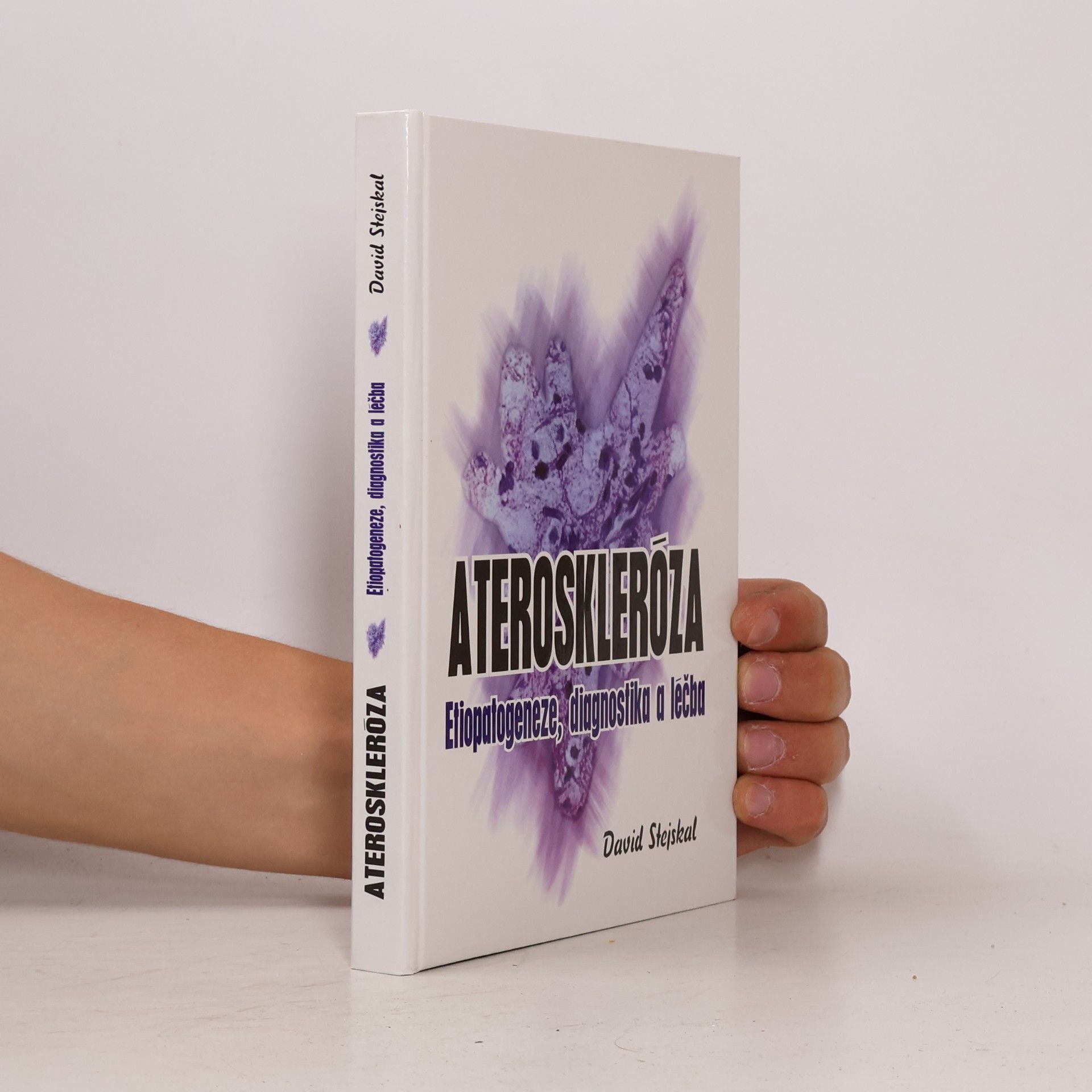 David Stejskal Ateroskleróza: Etiopatogeneze, diagnostika a léčba