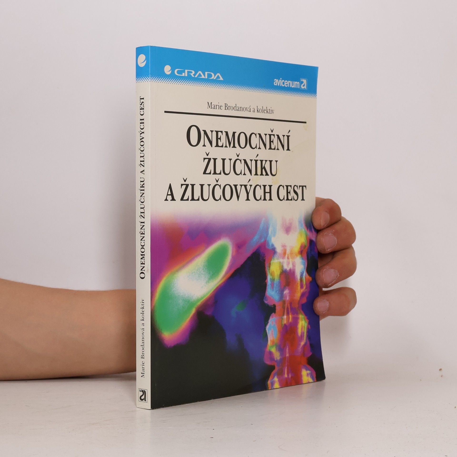 Marie Brodanová Onemocnění žlučníku a žlučových cest
