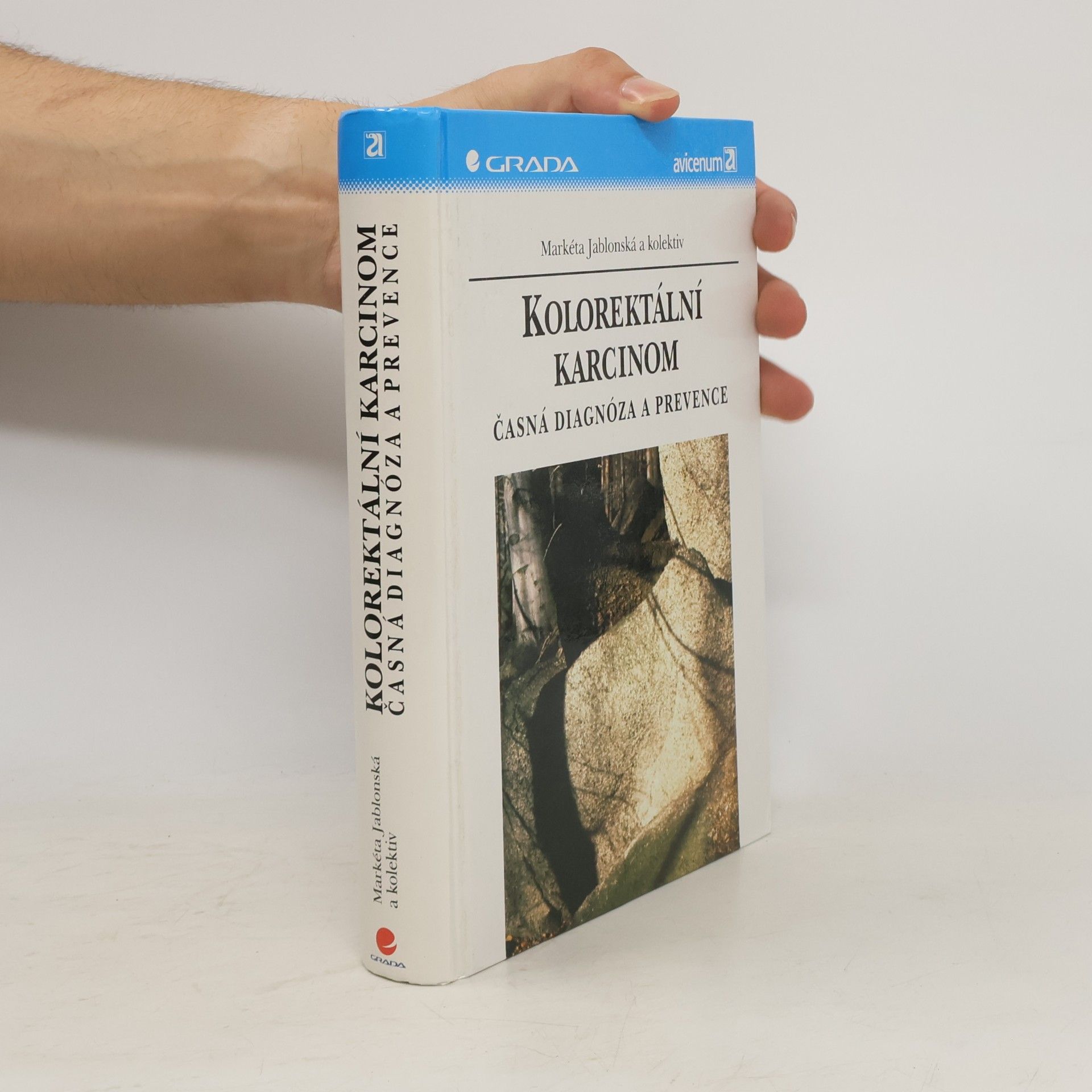 Markéta Jablonská Kolorektální karcinom : časná diagnóza a prevence