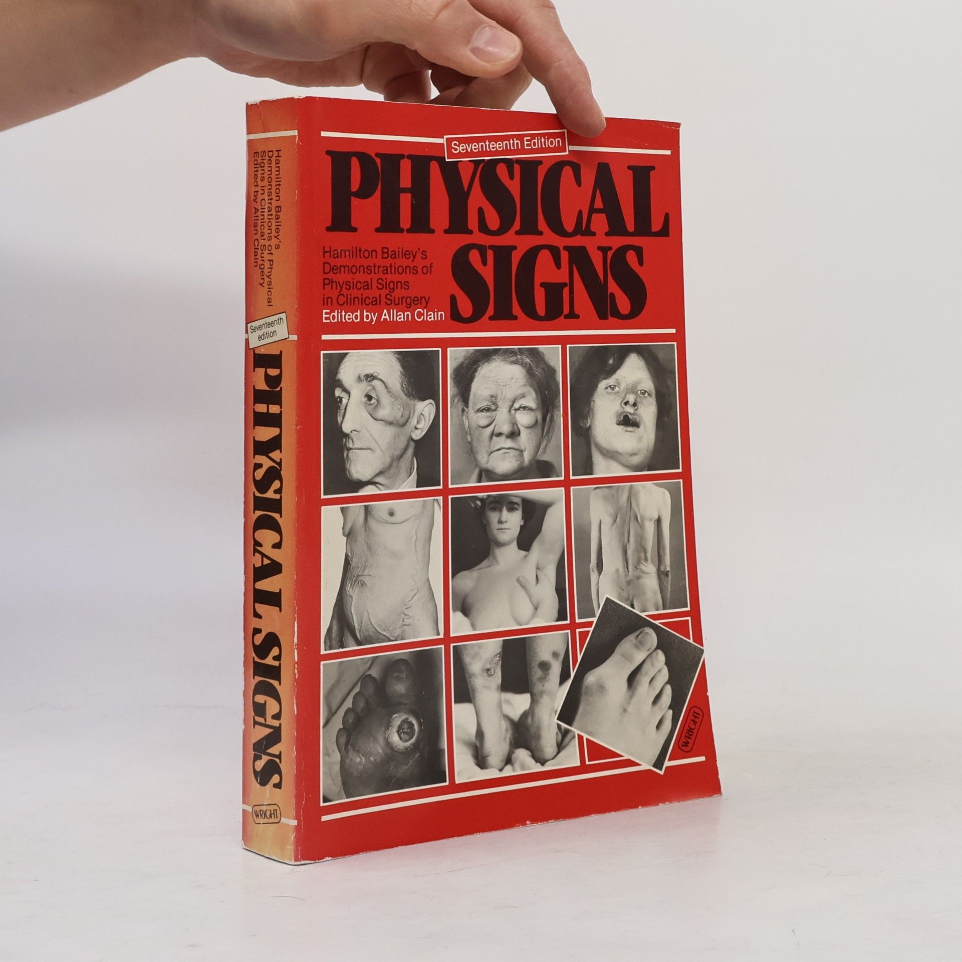 Hamilton Bailey's Demonstrations of Physical Signs in Clinical Surgery - Seventeenth Edition