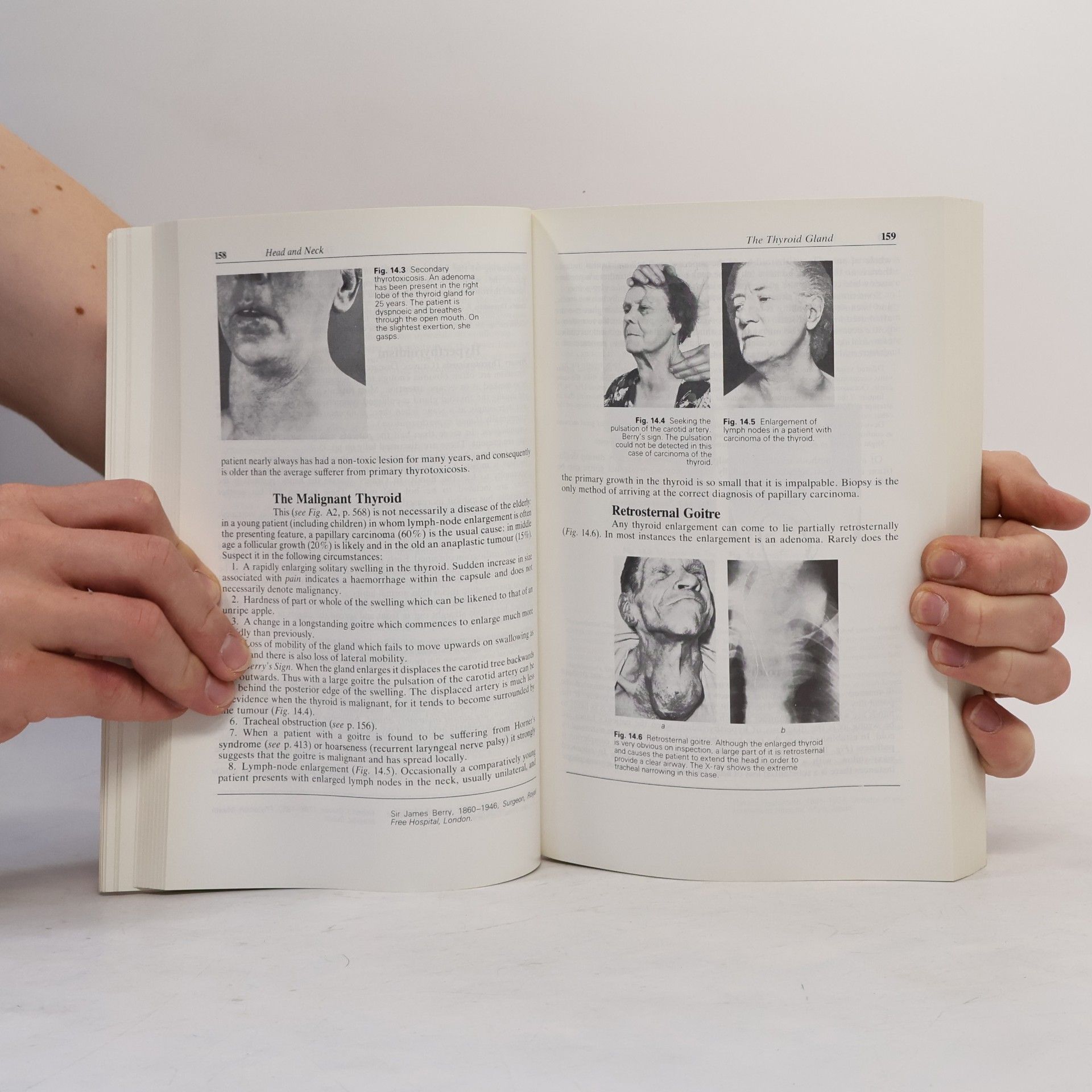 Hamilton Bailey Hamilton Bailey's Demonstrations of Physical Signs in Clinical Surgery - Seventeenth Edition