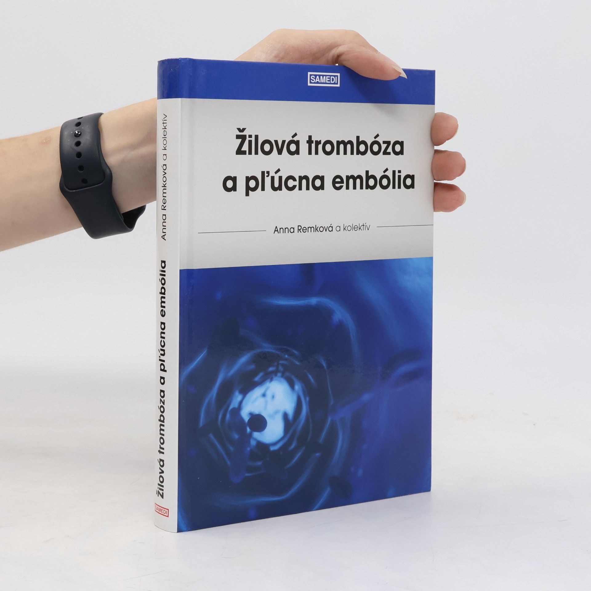 Anna Remková Žilová trombóza a pľúcna embólia