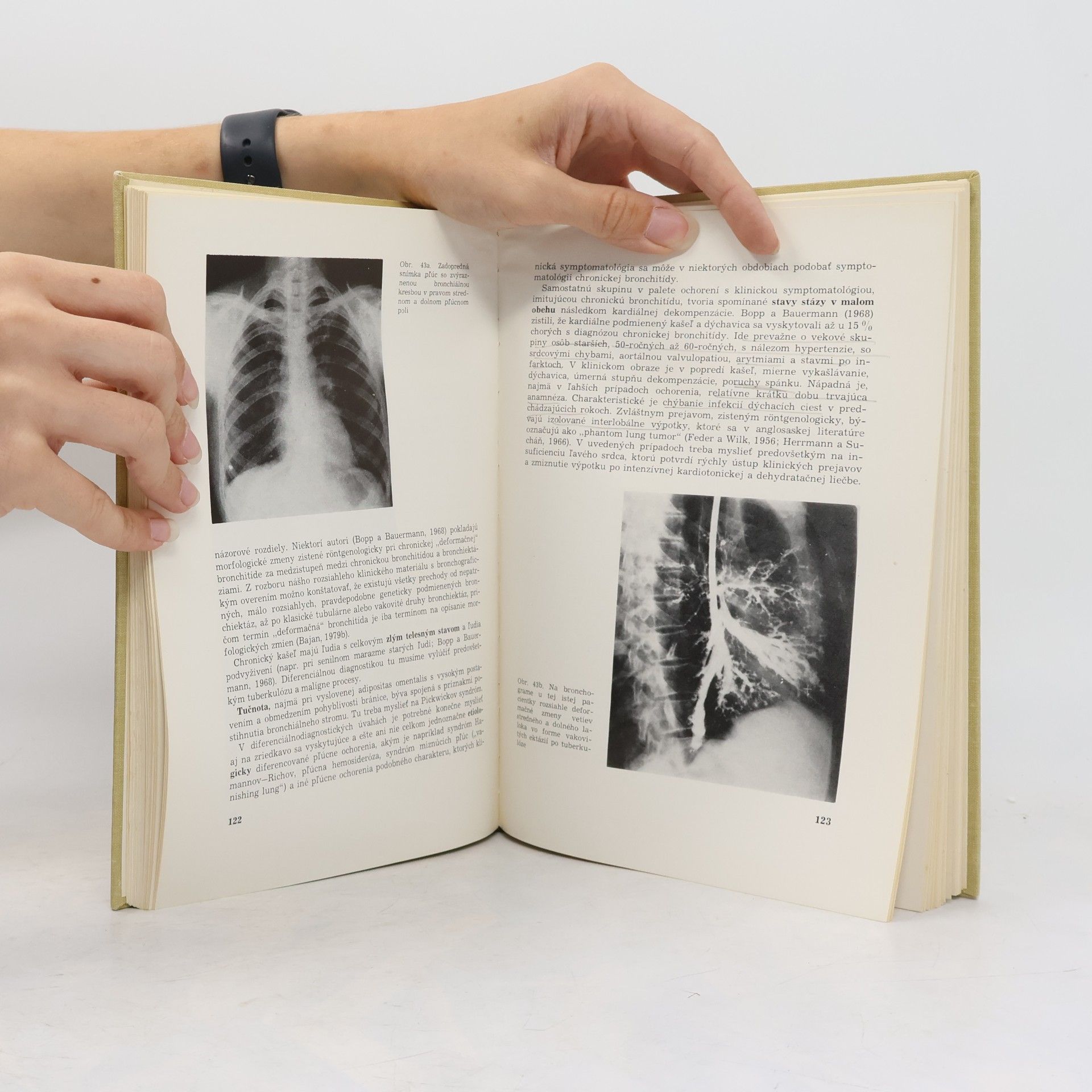 Anton Bajan Bronchitis chronica