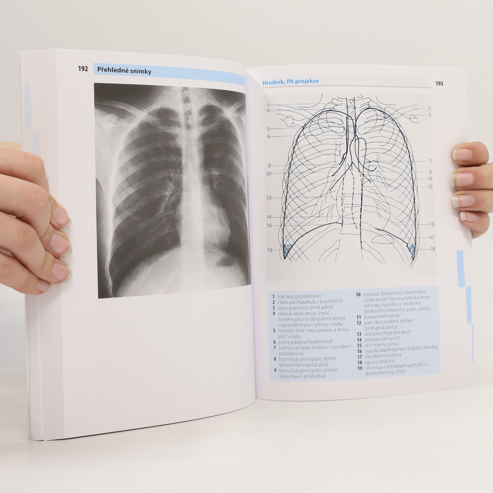 Torsten B. Möller Kapesní atlas rentgenové anatomie