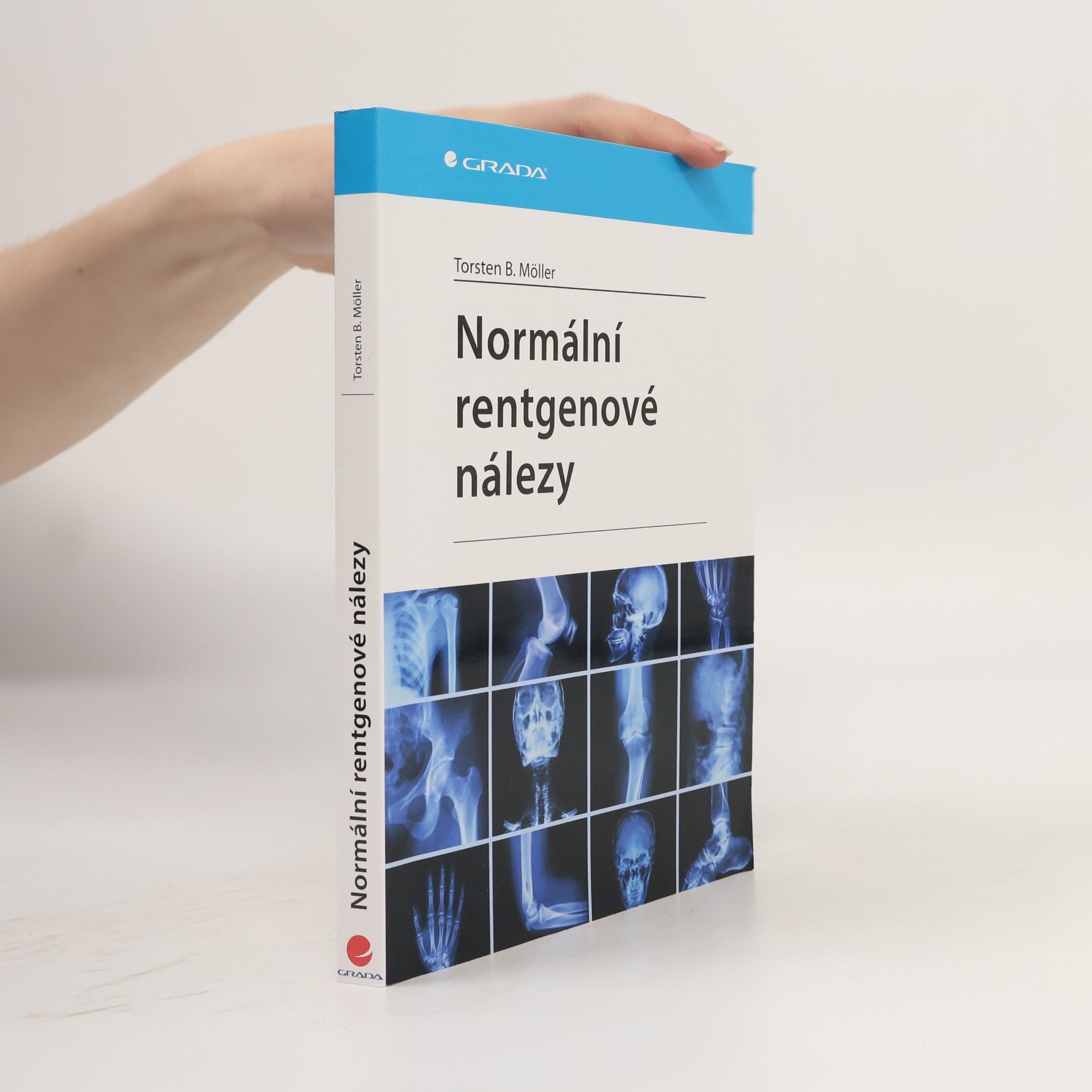 Torsten B. Möller Normální rentgenové nálezy