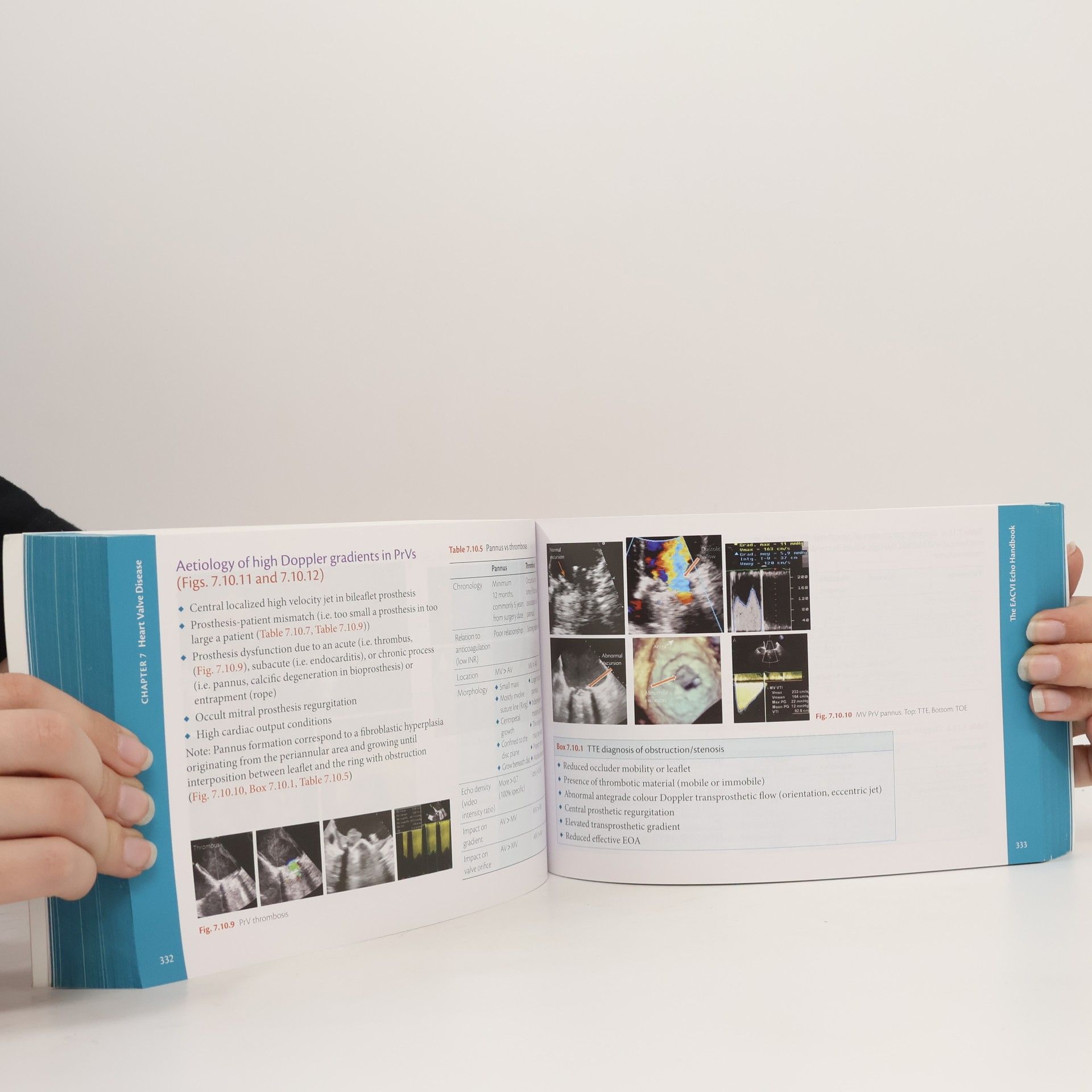 Bernard Cosyns The EACVI Echo Handbook