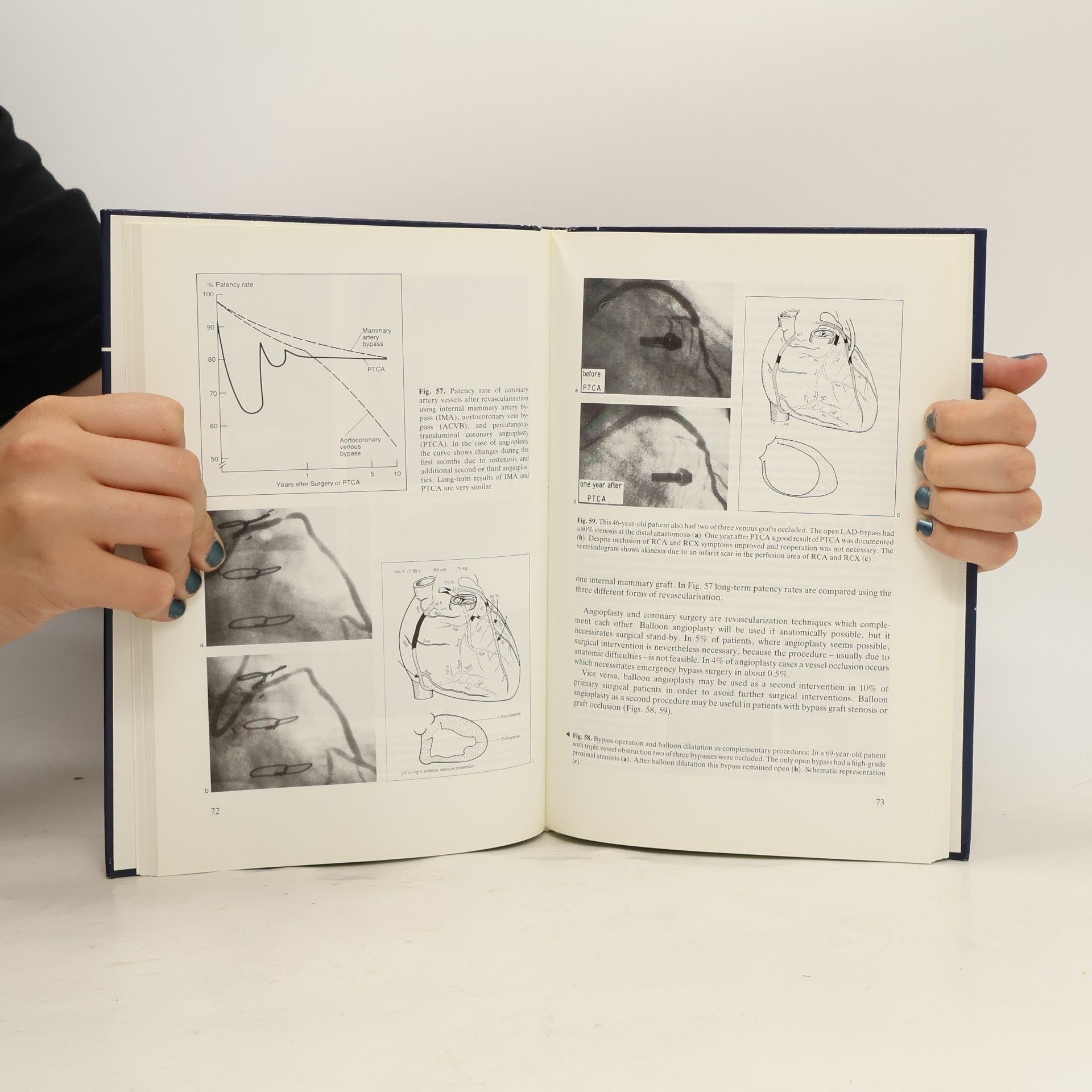 Martin Kaltenbach M: Monographs - 5: Concise Cardiology