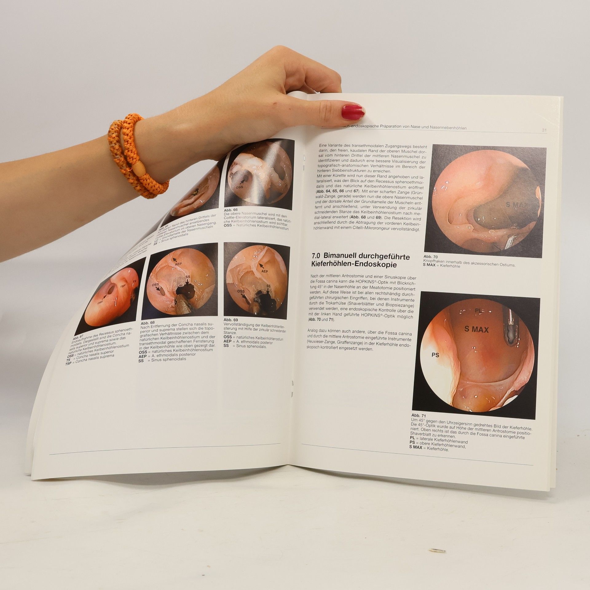 Paolo Castelnuovo Die Anatomisch-Endoskopische Präparation von Nase und Nasennebenhöhlen