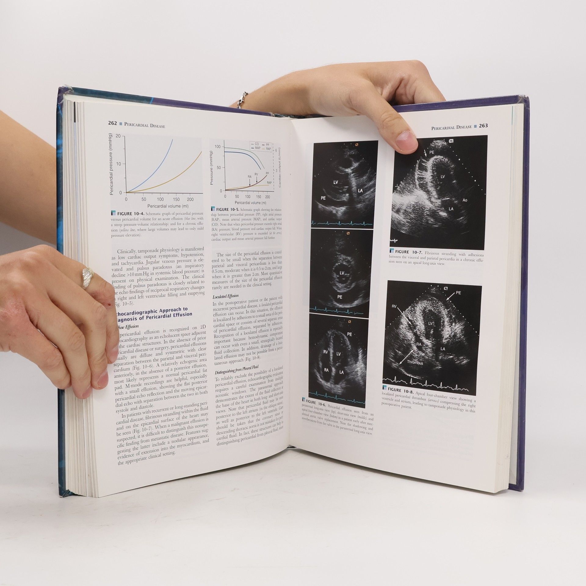 Catherine M. Otto Textbook of Clinical Echocardiography - 3rd Edition