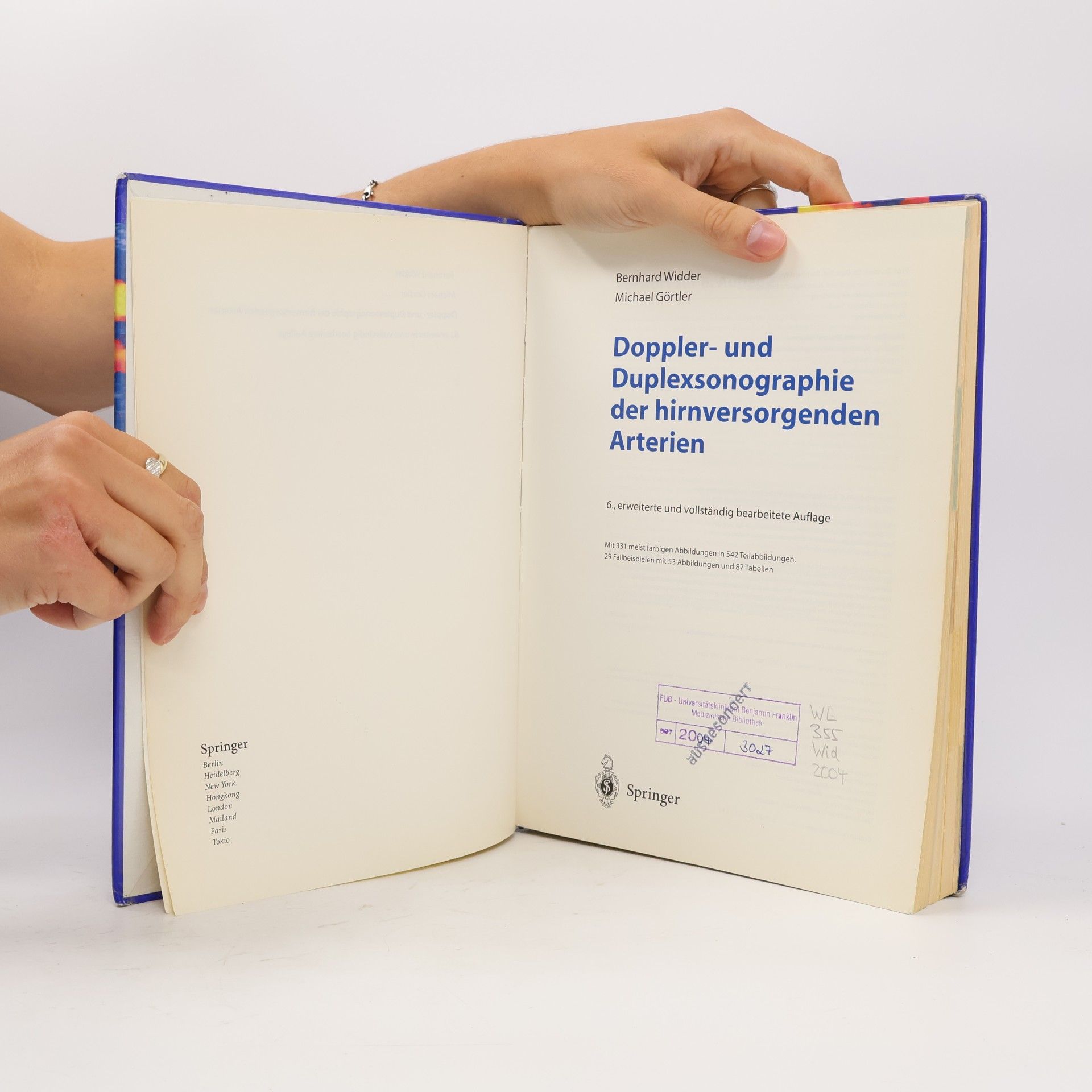 Bernhard Widder Doppler- und Duplexsonographie der hirnversorgenden Arterien - 6. Auflage
