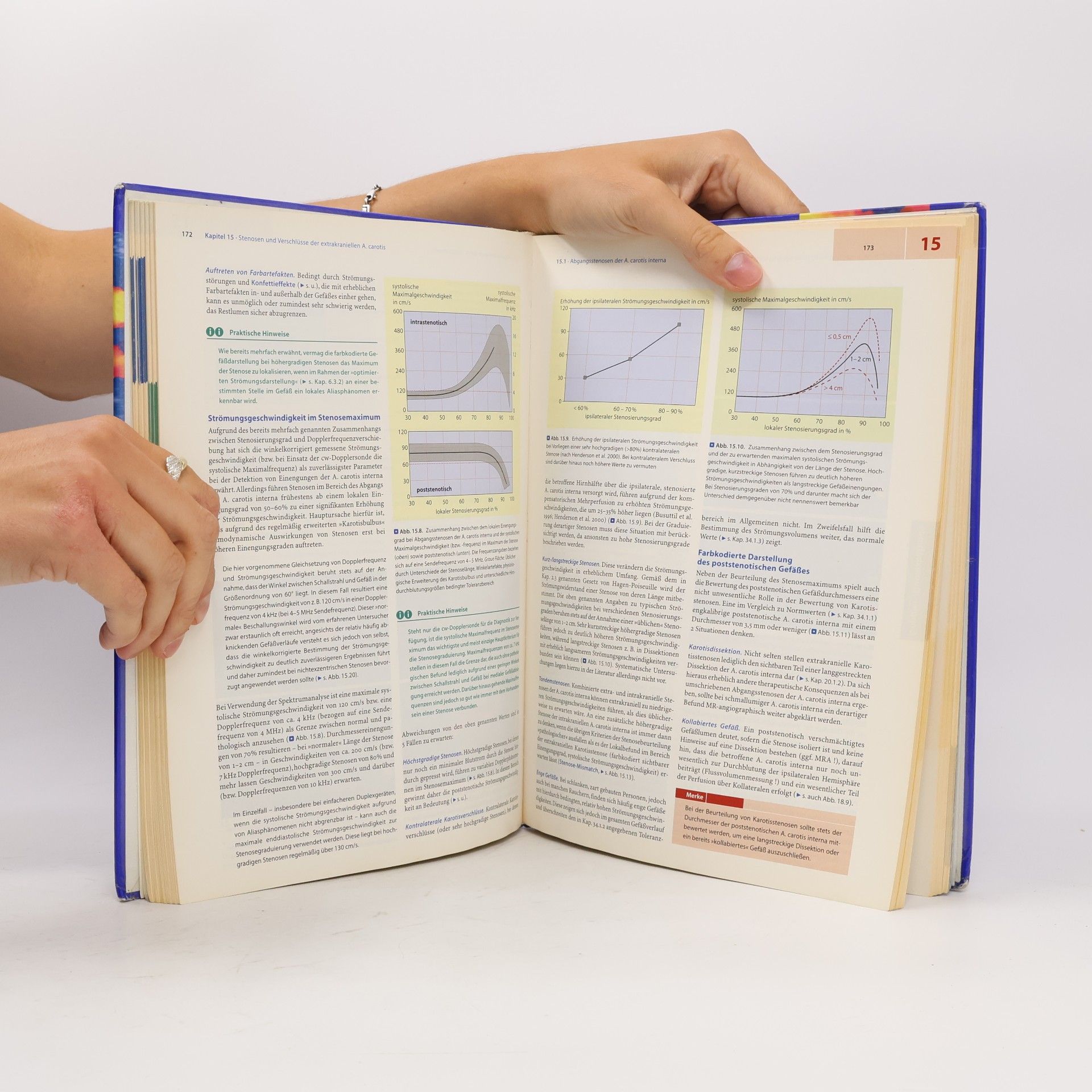 Bernhard Widder Doppler- und Duplexsonographie der hirnversorgenden Arterien - 6. Auflage