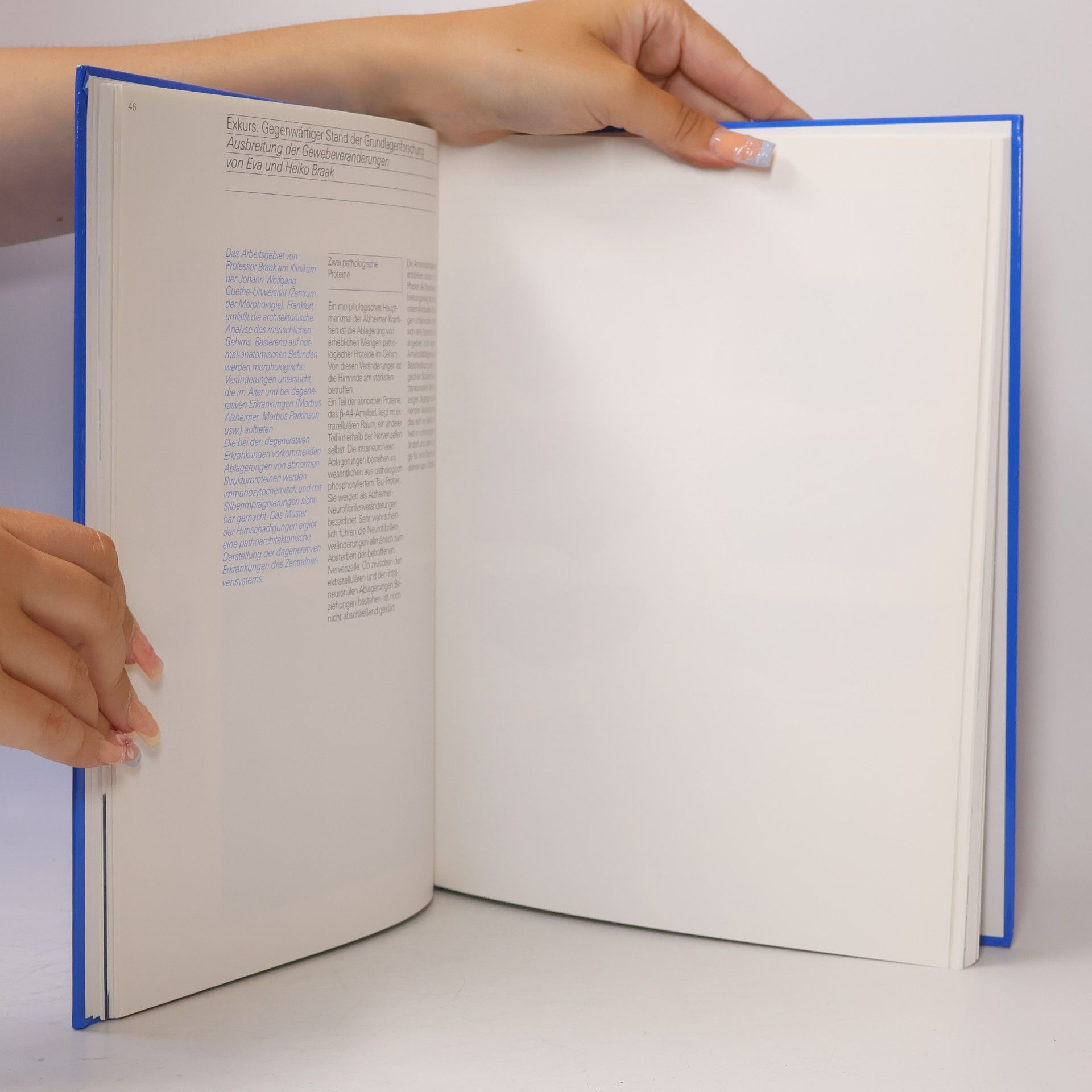 Various authors Alzheimer-Patienten erkennen und behandeln