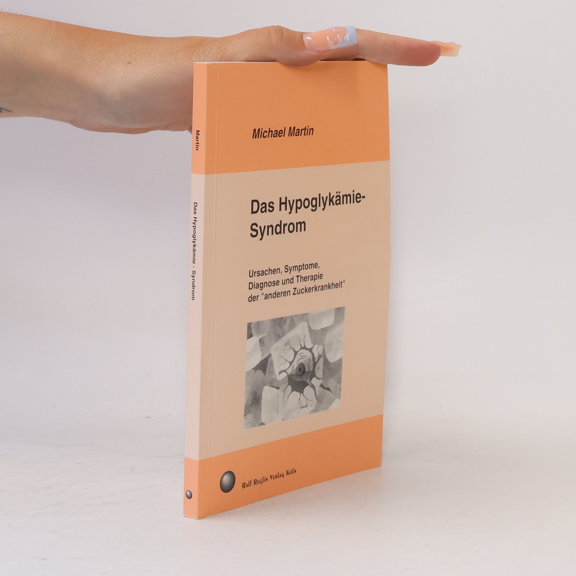 Das Hypoglykämie-Syndrom