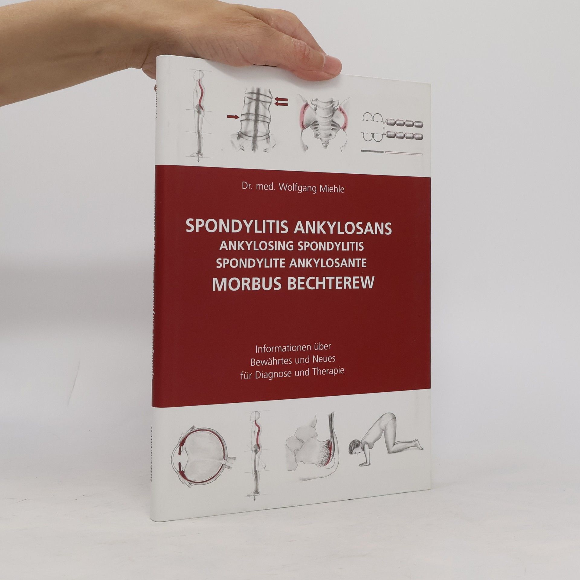 Wolfgang Miehle Spondylitis ankylosans - Morbus Bechterew