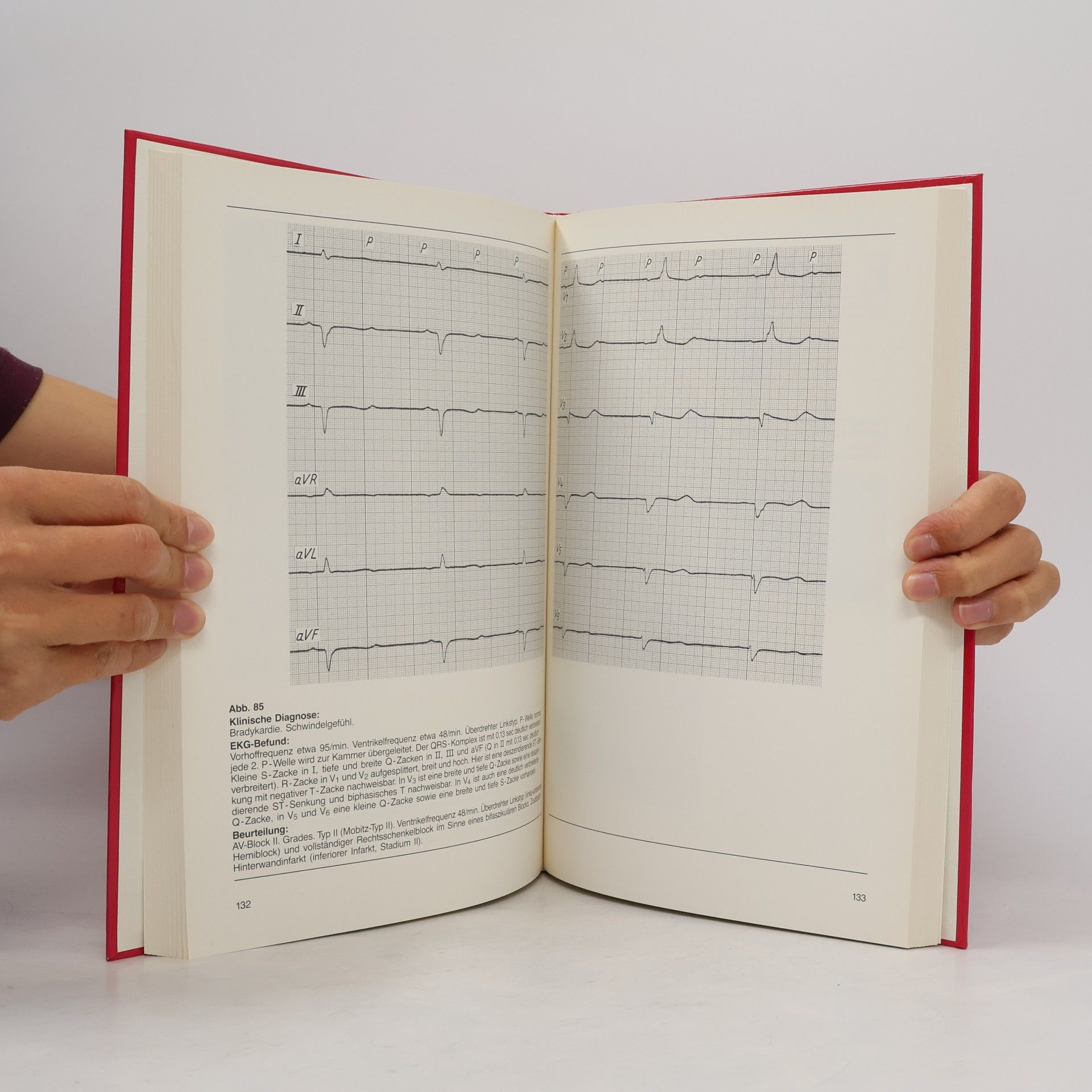 Cook Sup So EKG-Atlas