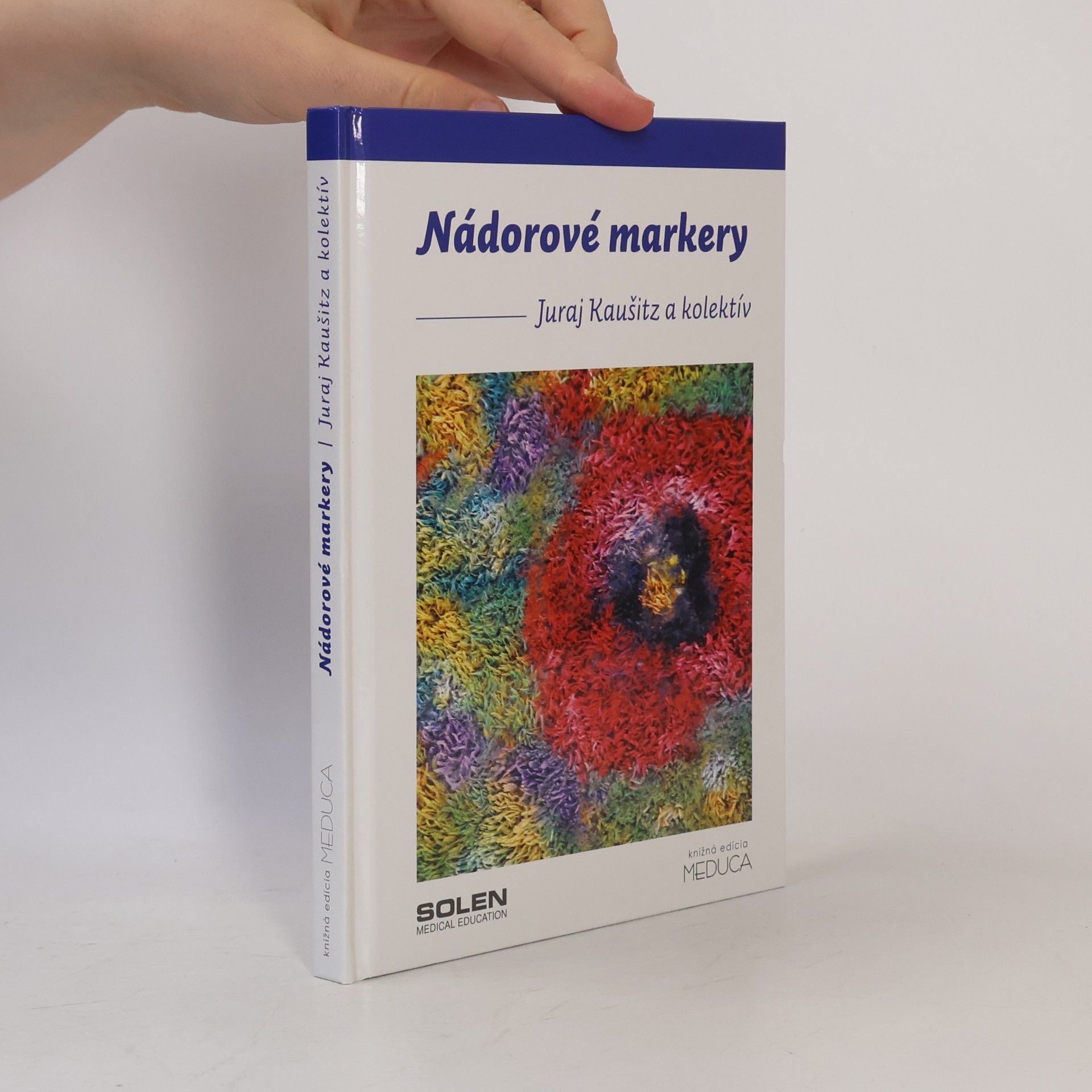 Juraj Kaušitz Nádorové markery
