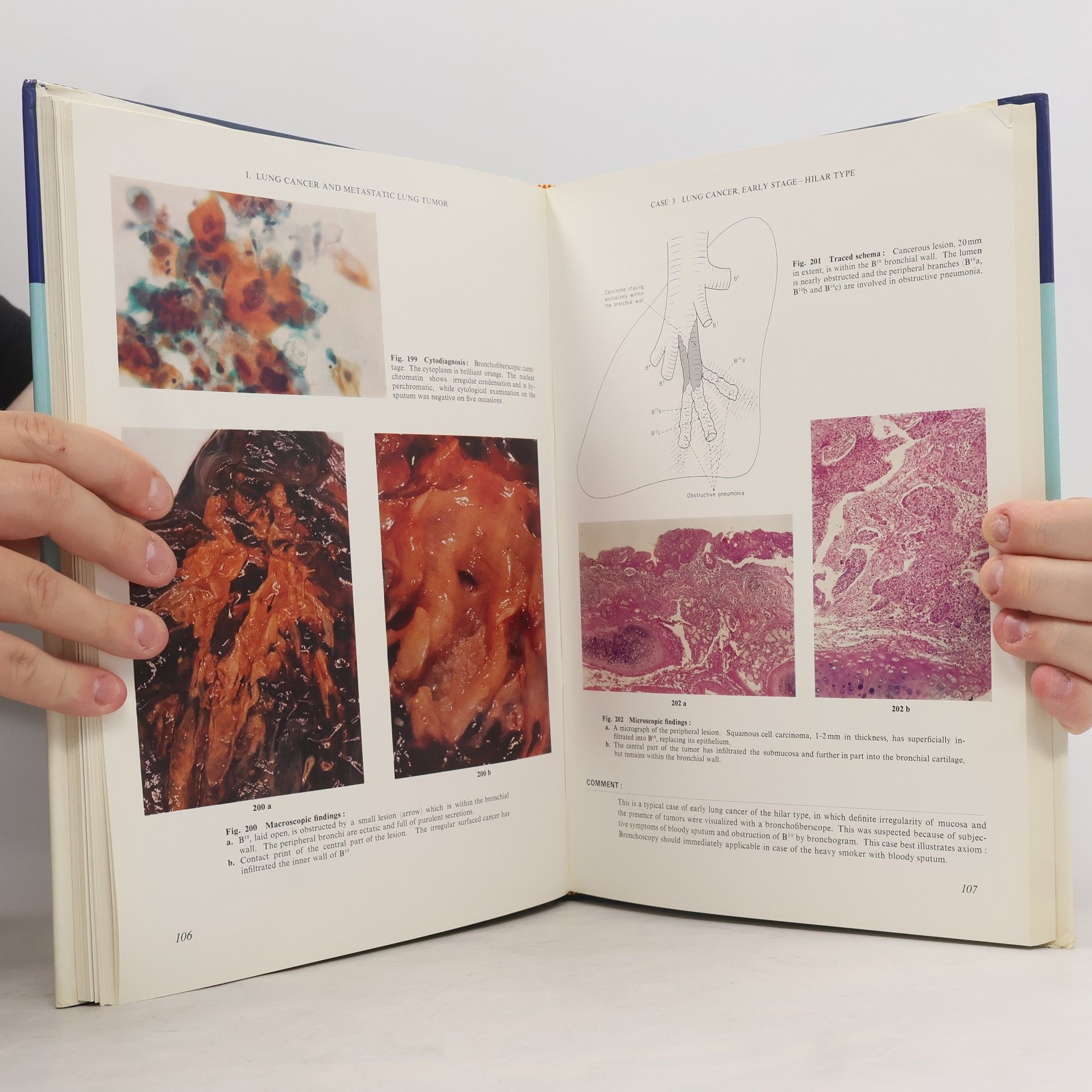 Shigeto Ikeda Atlas of Flexible Bronchofiberscopy
