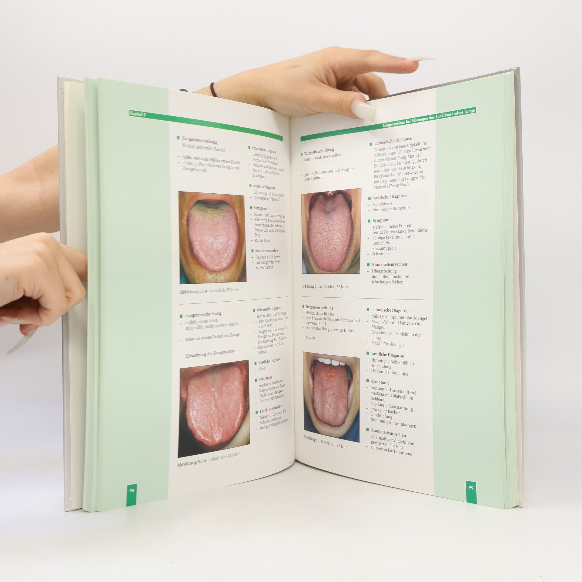 Barbara Kirschbaum Atlas und Lehrbuch der chinesischen Zungendiagnostik