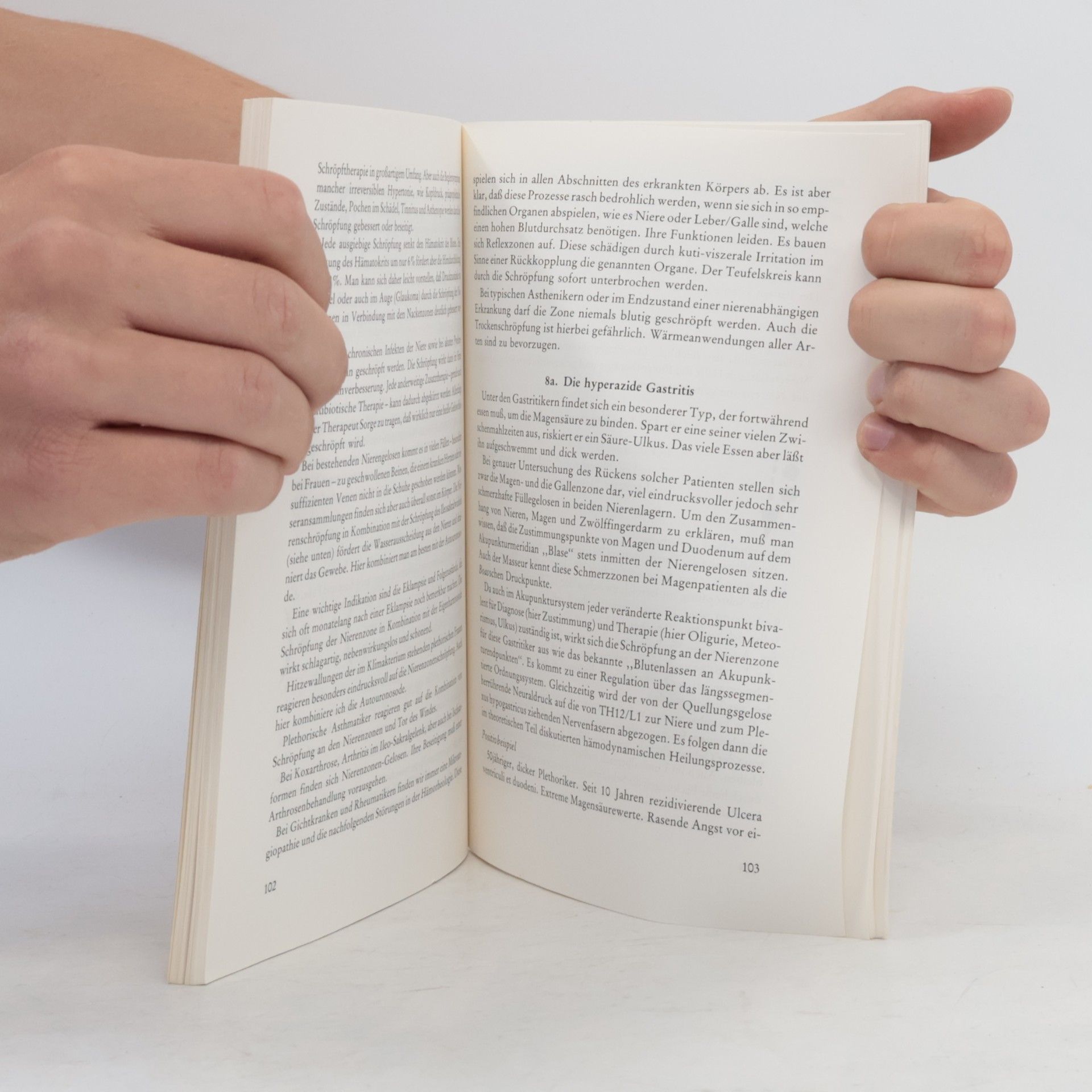 Johann Abele Lehrbuch der Schröpfkopfbehandlung