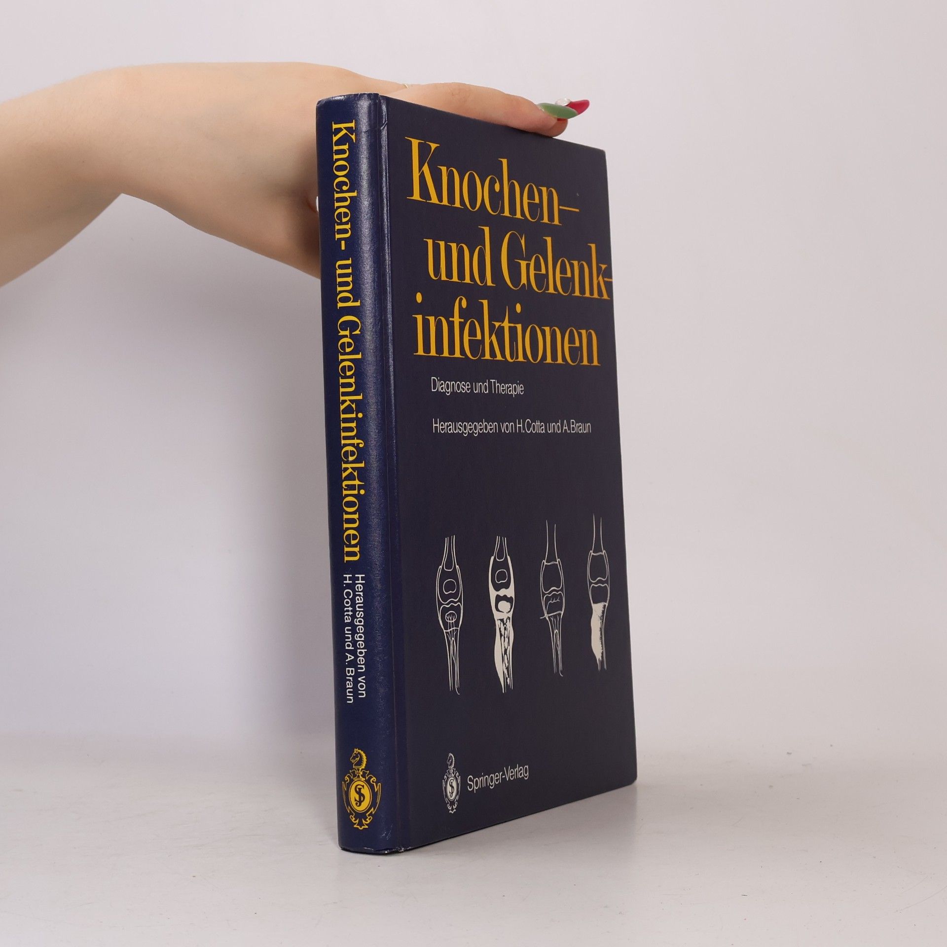 Arnim Braun Knochen- und Gelenkinfektionen