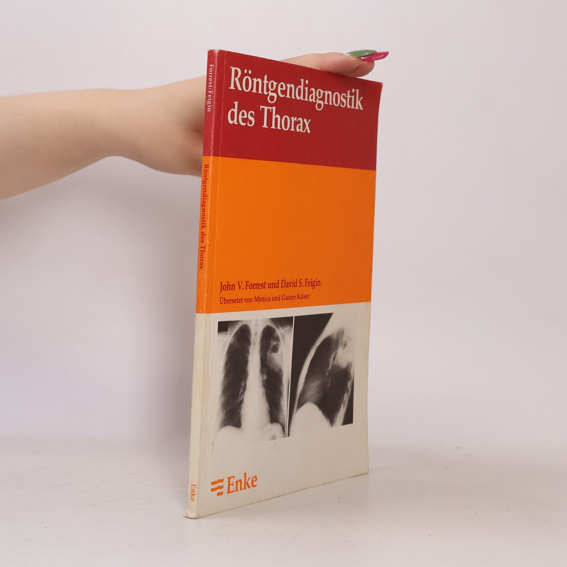 John V. Forrest Röntgendiagnostik des Thorax