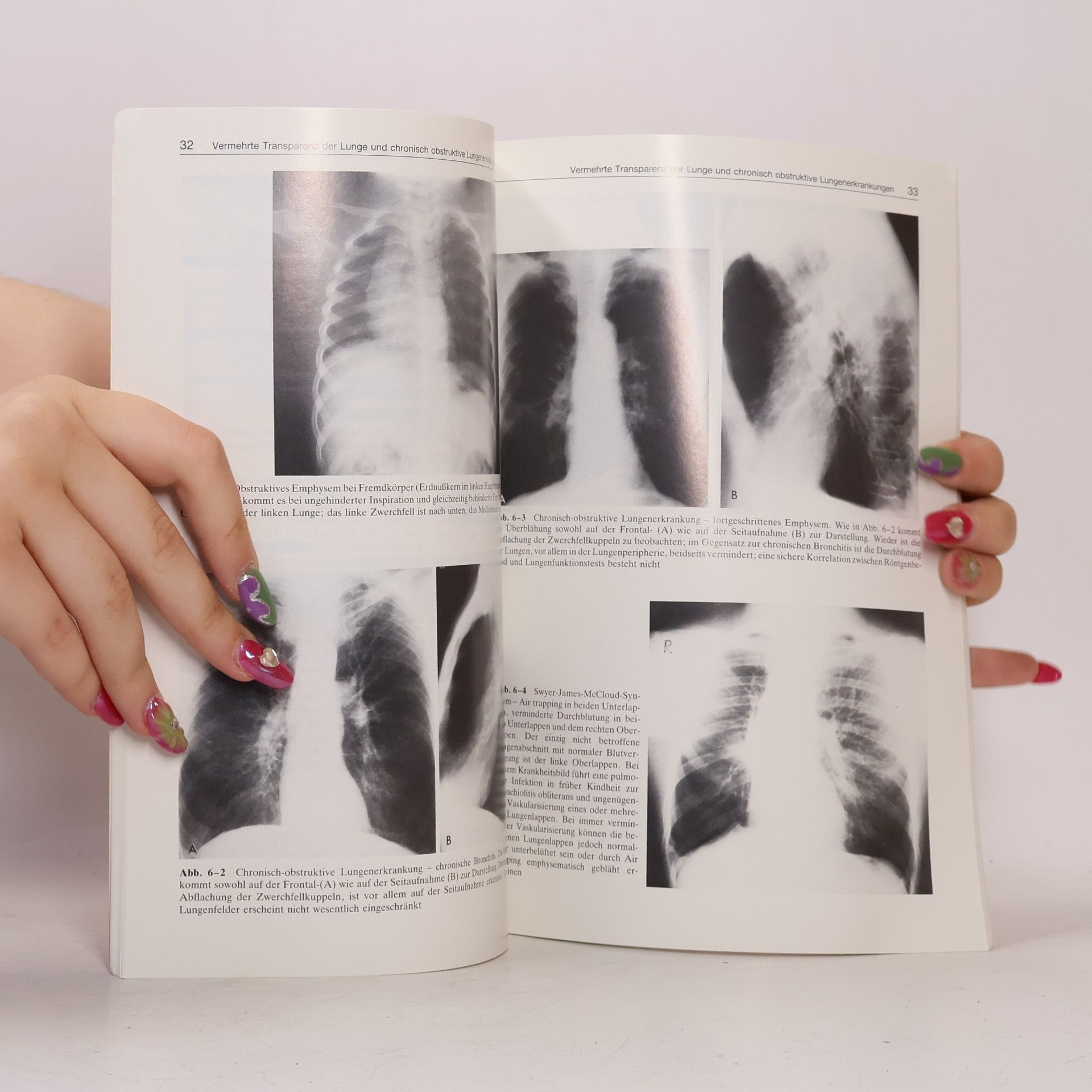 John V. Forrest Röntgendiagnostik des Thorax