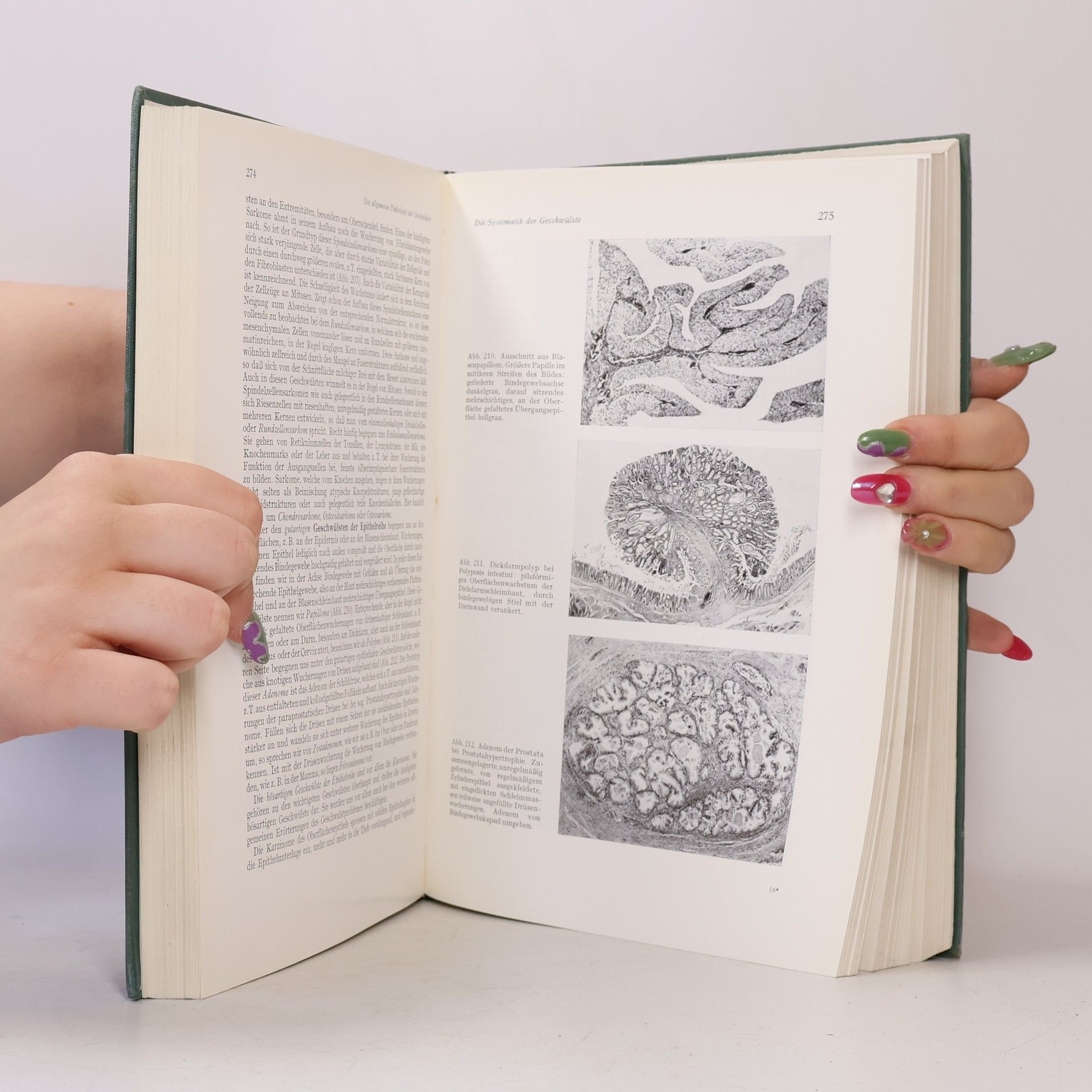 Franz Büchner Allgemeine Pathologie