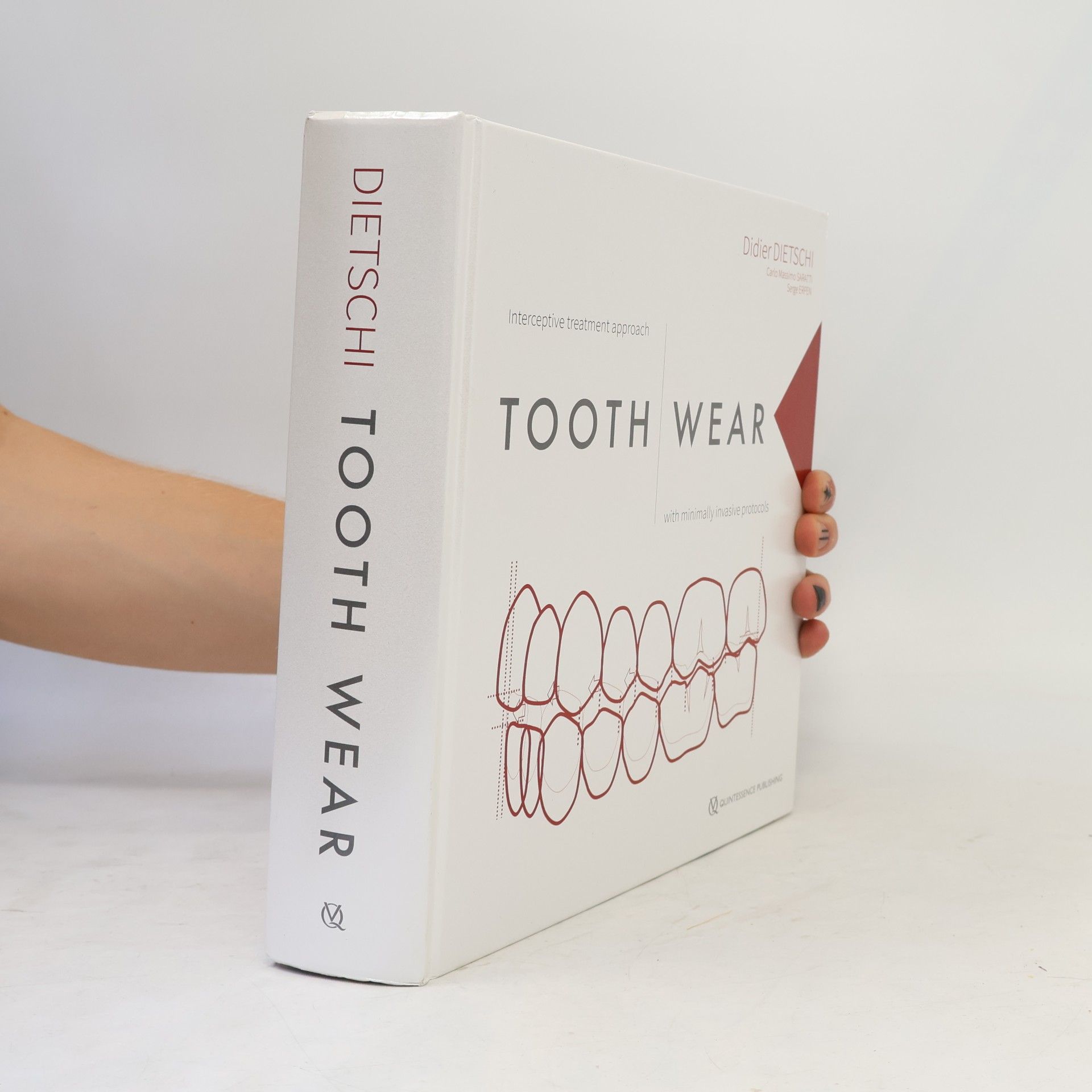 Didier Dietschi Tooth Wear