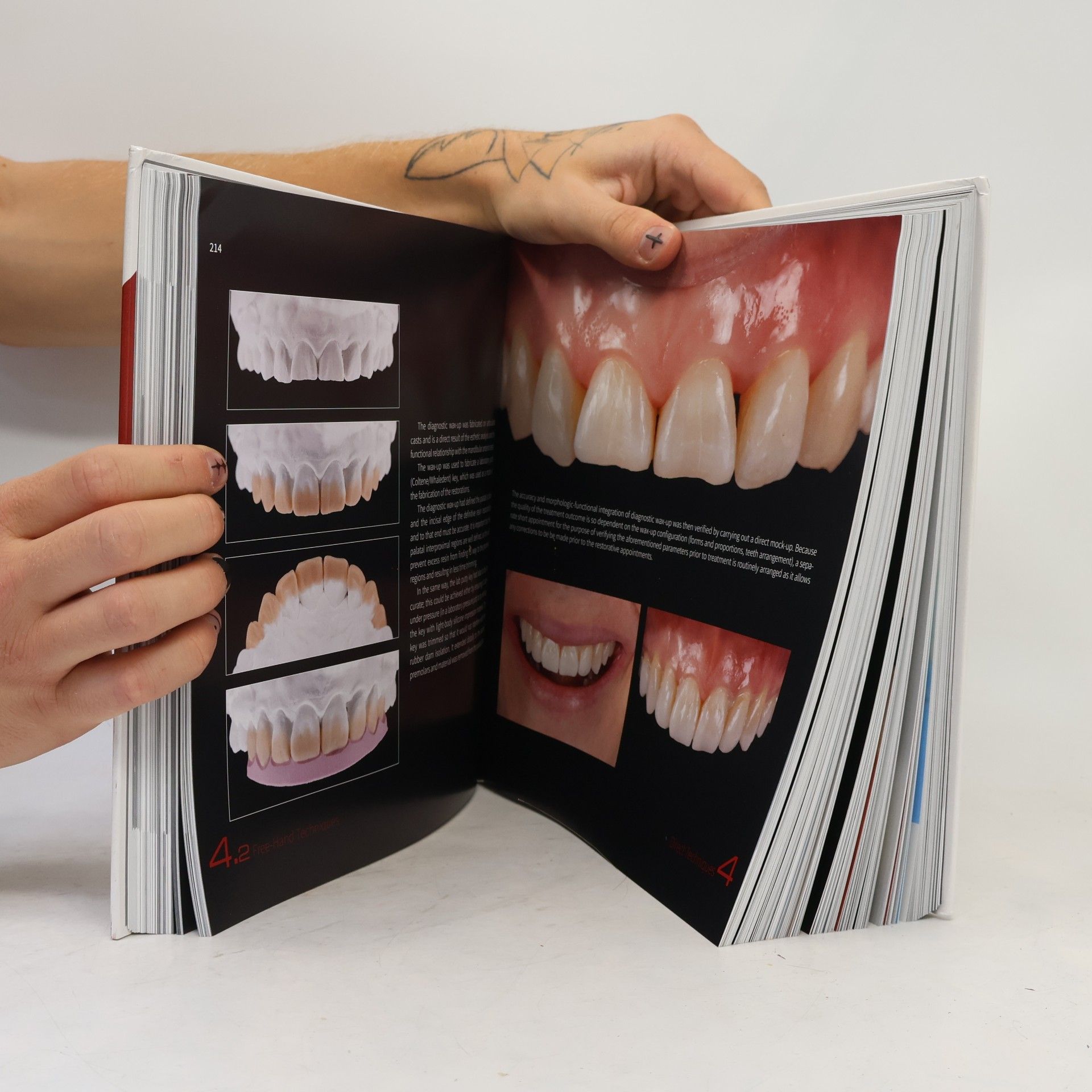 Didier Dietschi Tooth Wear