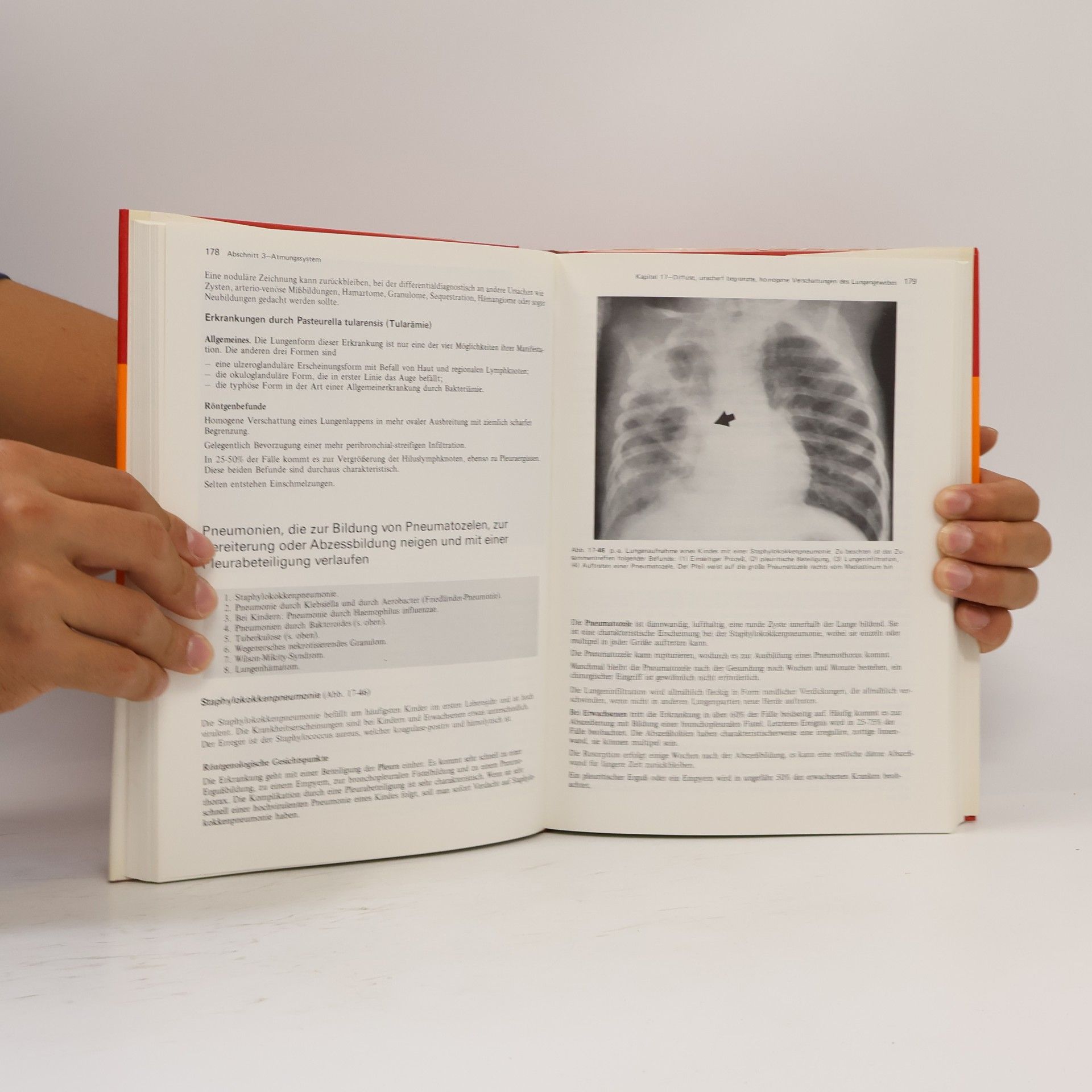 Isadore Meschan Klinische Radiologie - 2: Analyse der Röntgenbilder