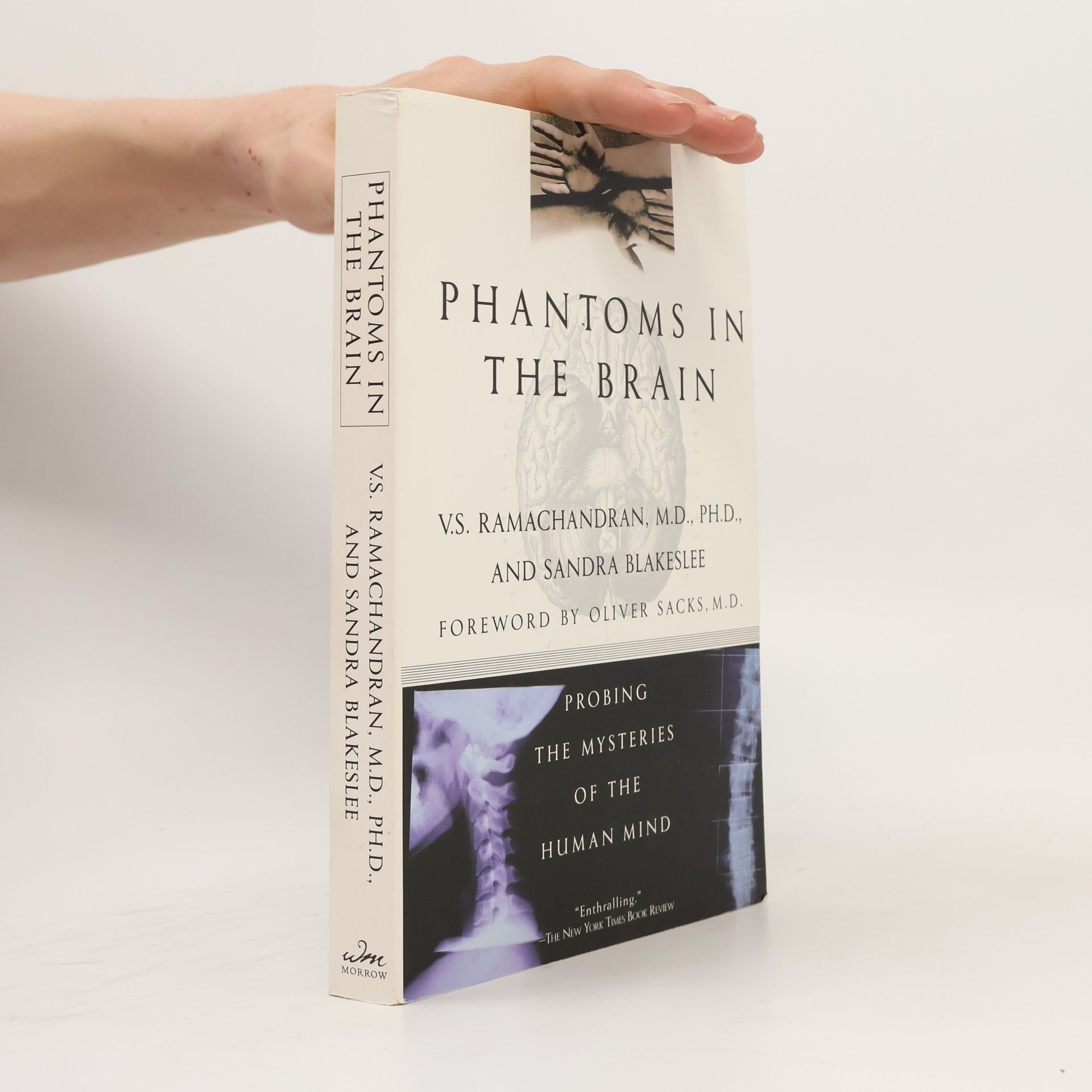 V. S. Ramachandran Phantoms in the Brain