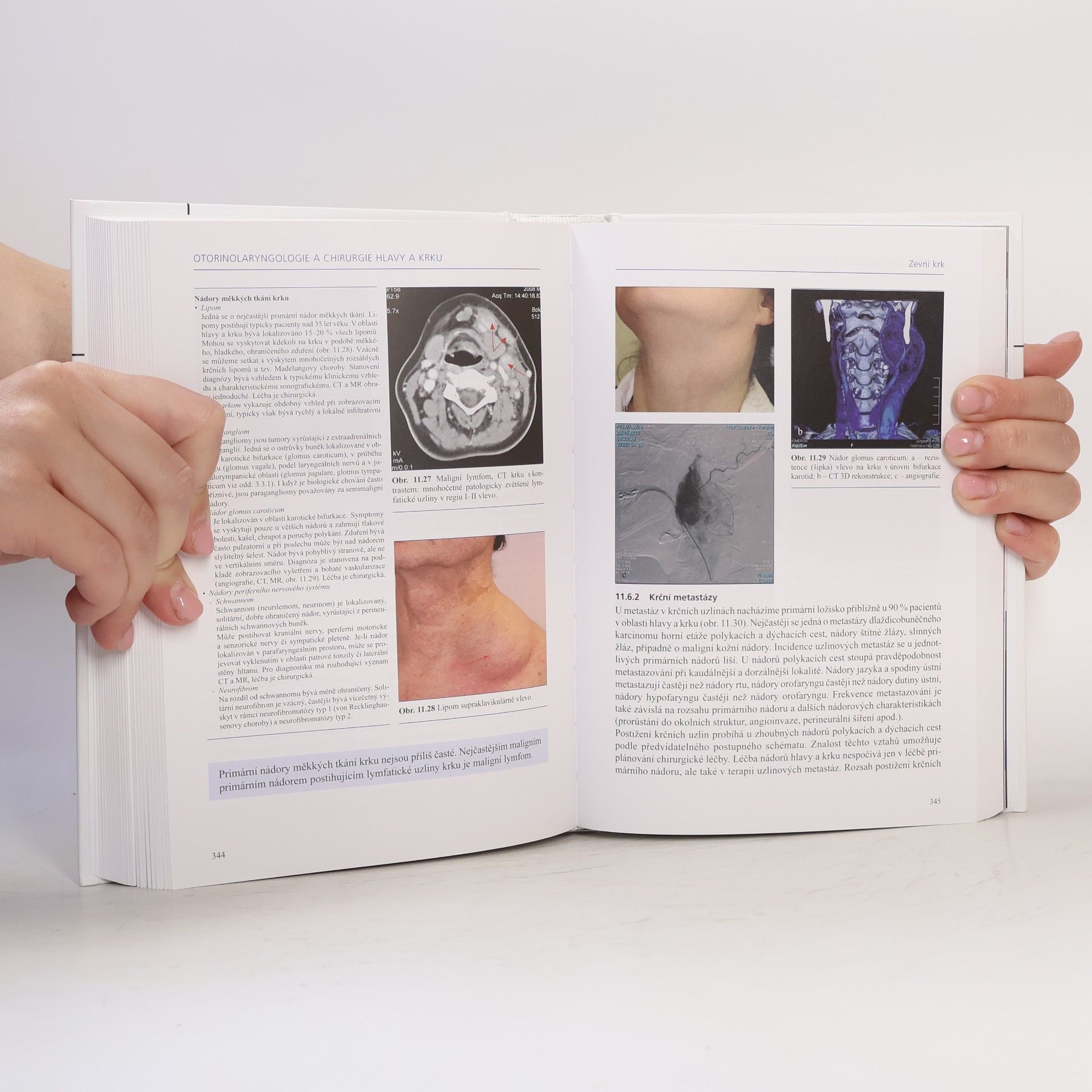 Kolektív autorov Otorinolaryngologie a chirurgie hlavy a krku