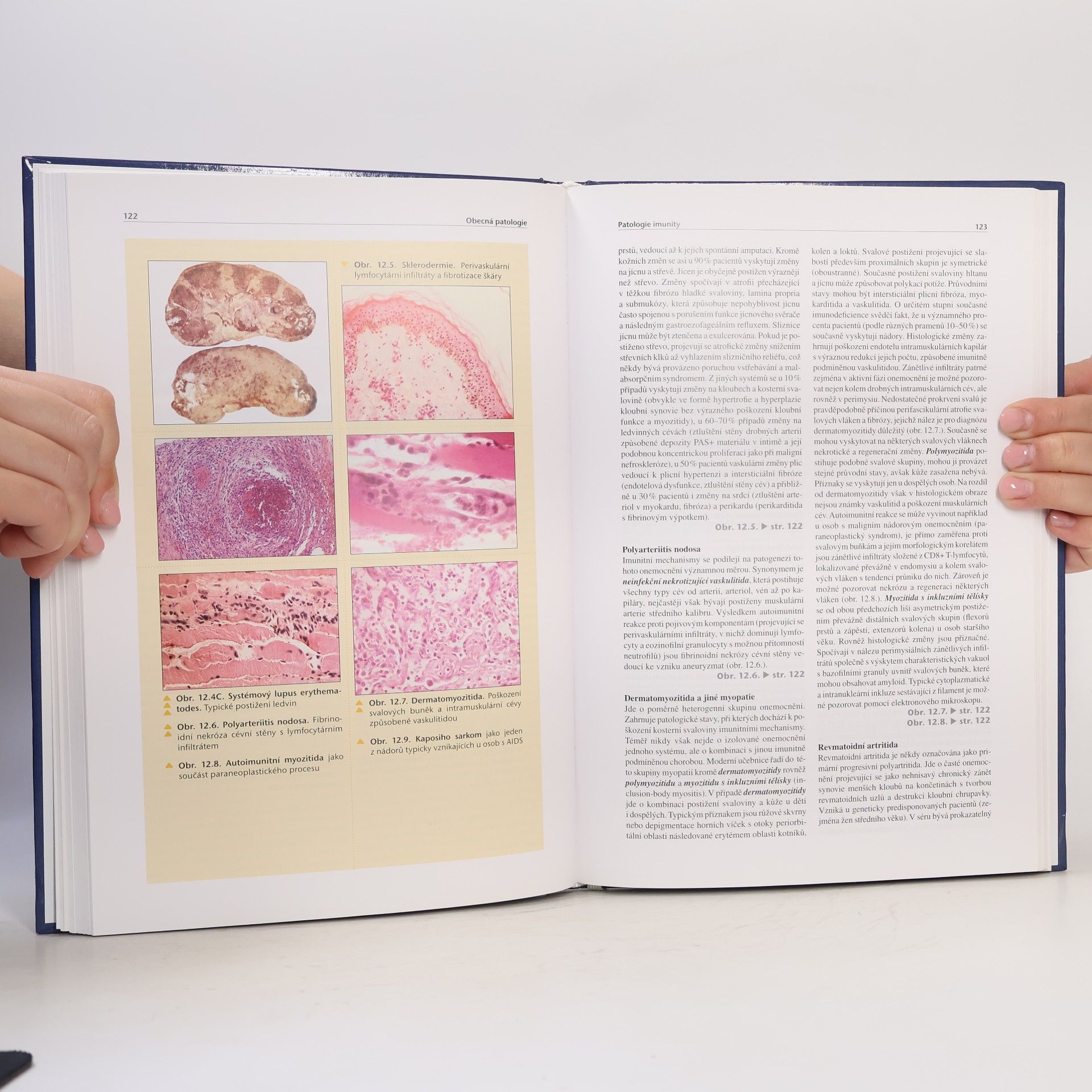 Ctibor Povýšil Obecná patologie