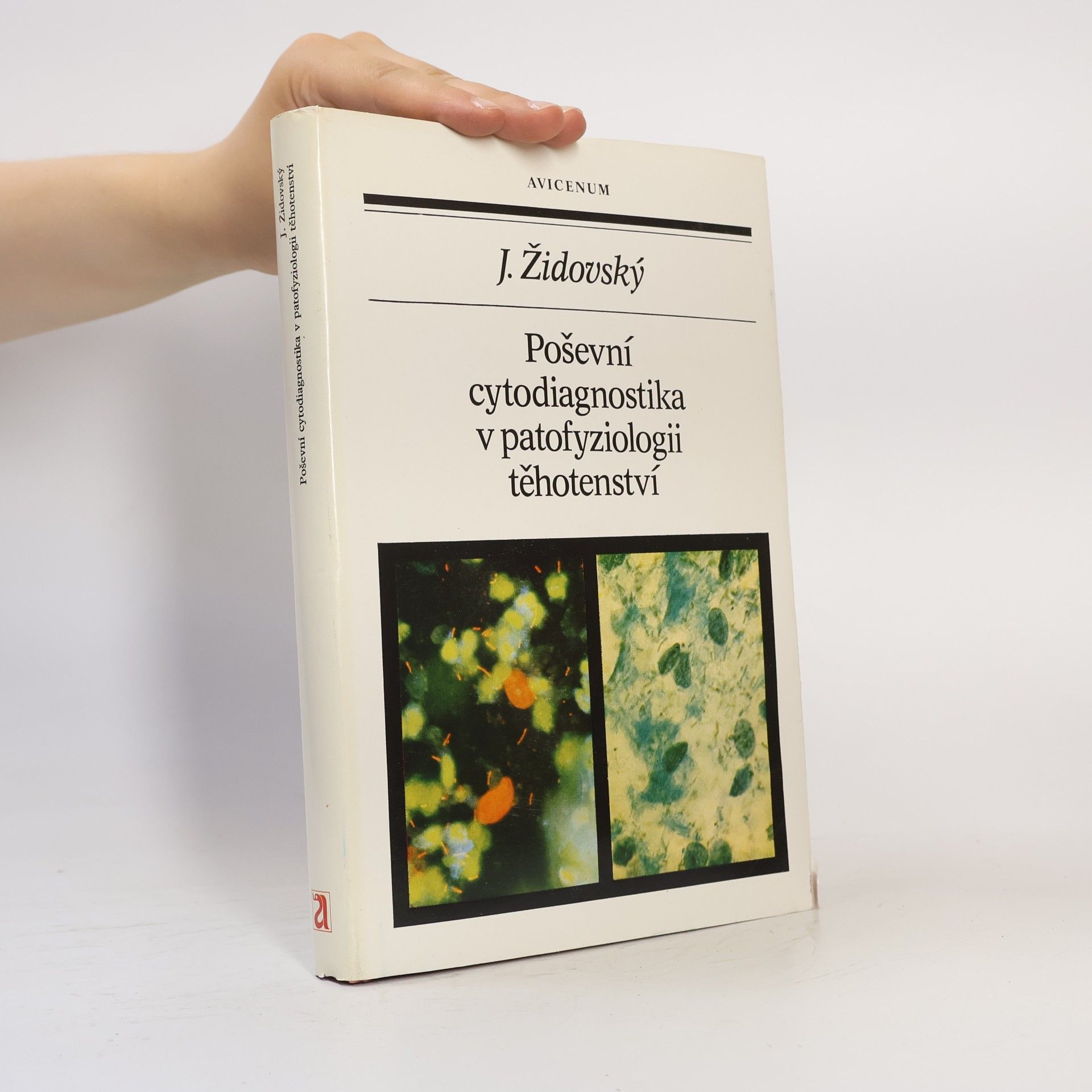 Jan Židovský Poševní cytodiagnostika v patofyziologii těhotenství