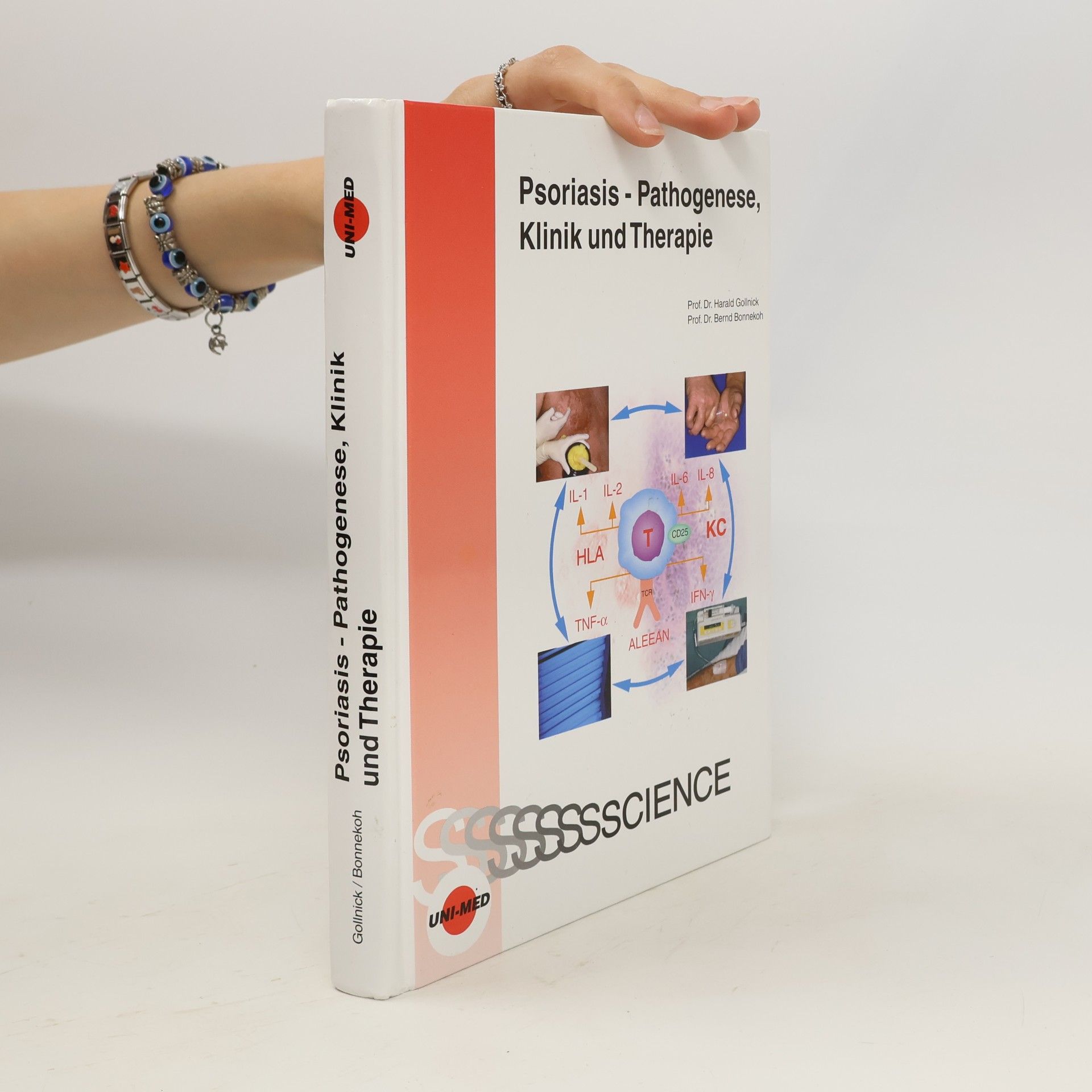 Bernd Bonnekoh Psoriasis - Pathogenese, Klinik und Therapie