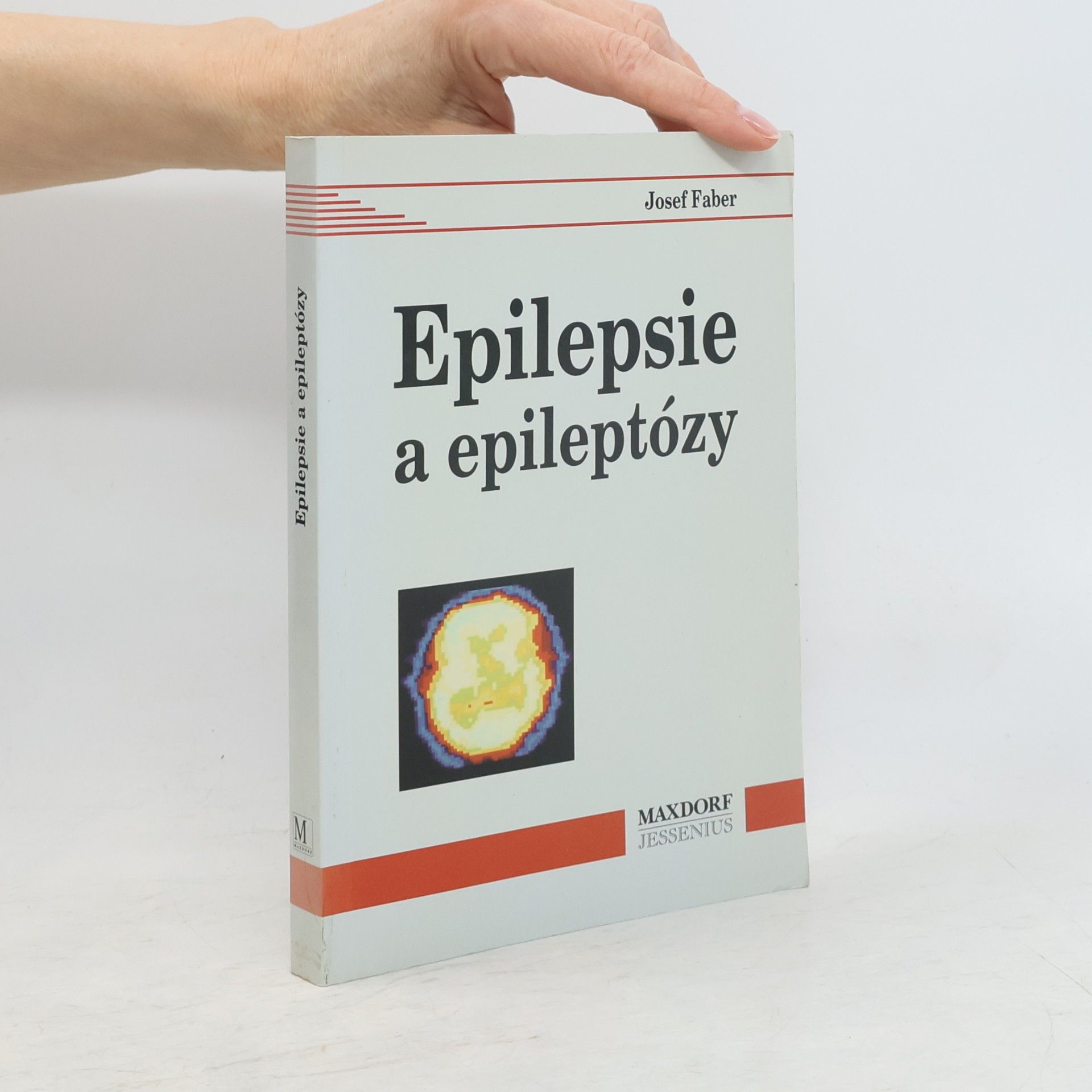 Epilepsie a epileptózy