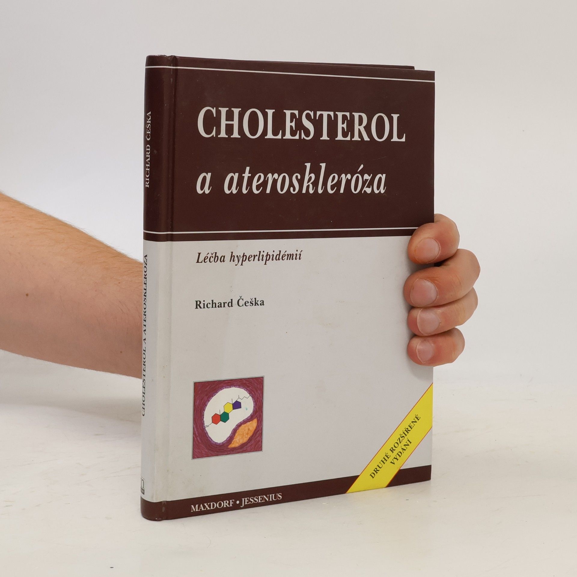 Richard Češka Cholesterol a ateroskleróza: Léčba hyperlipidémií