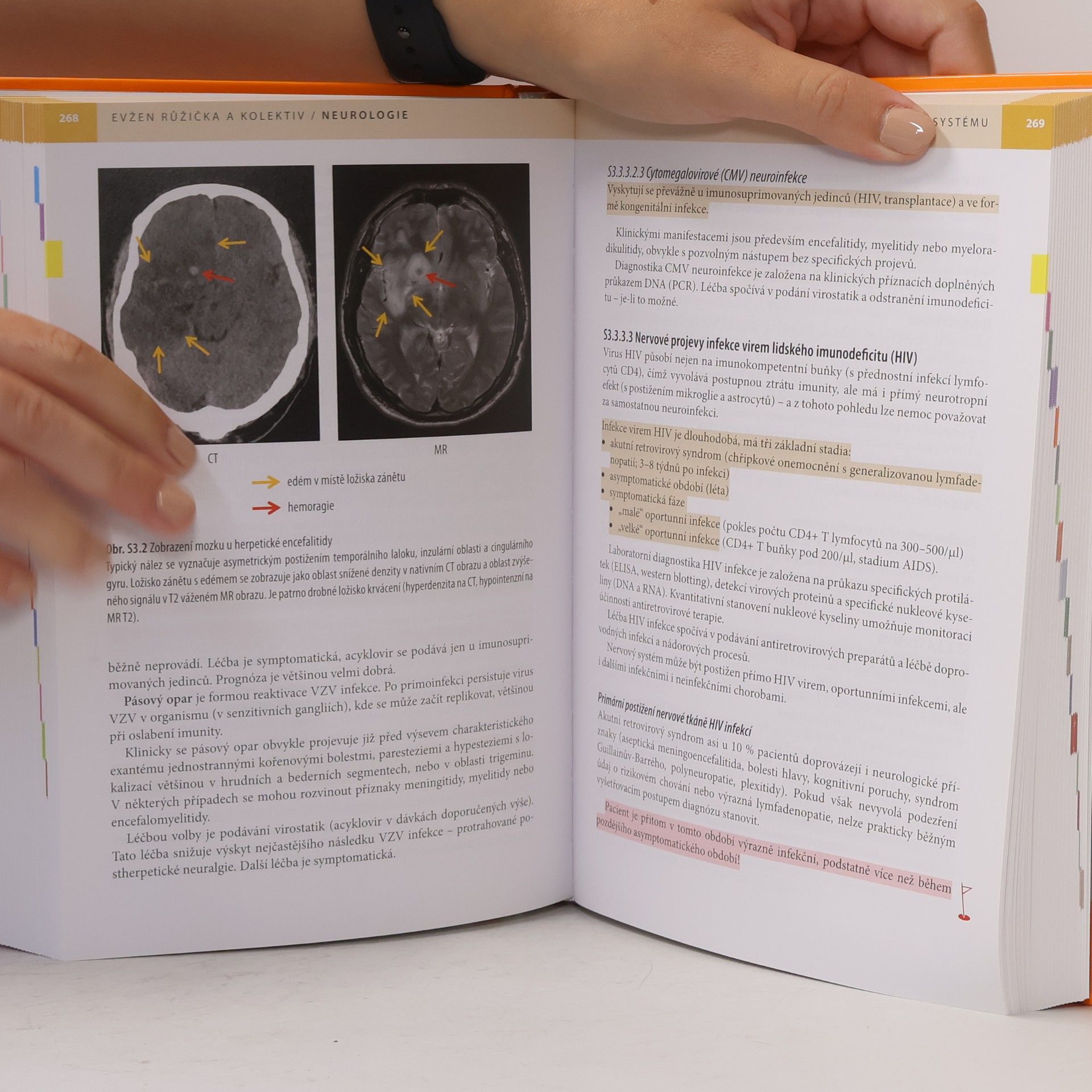 Evžen Růžička Neurologie