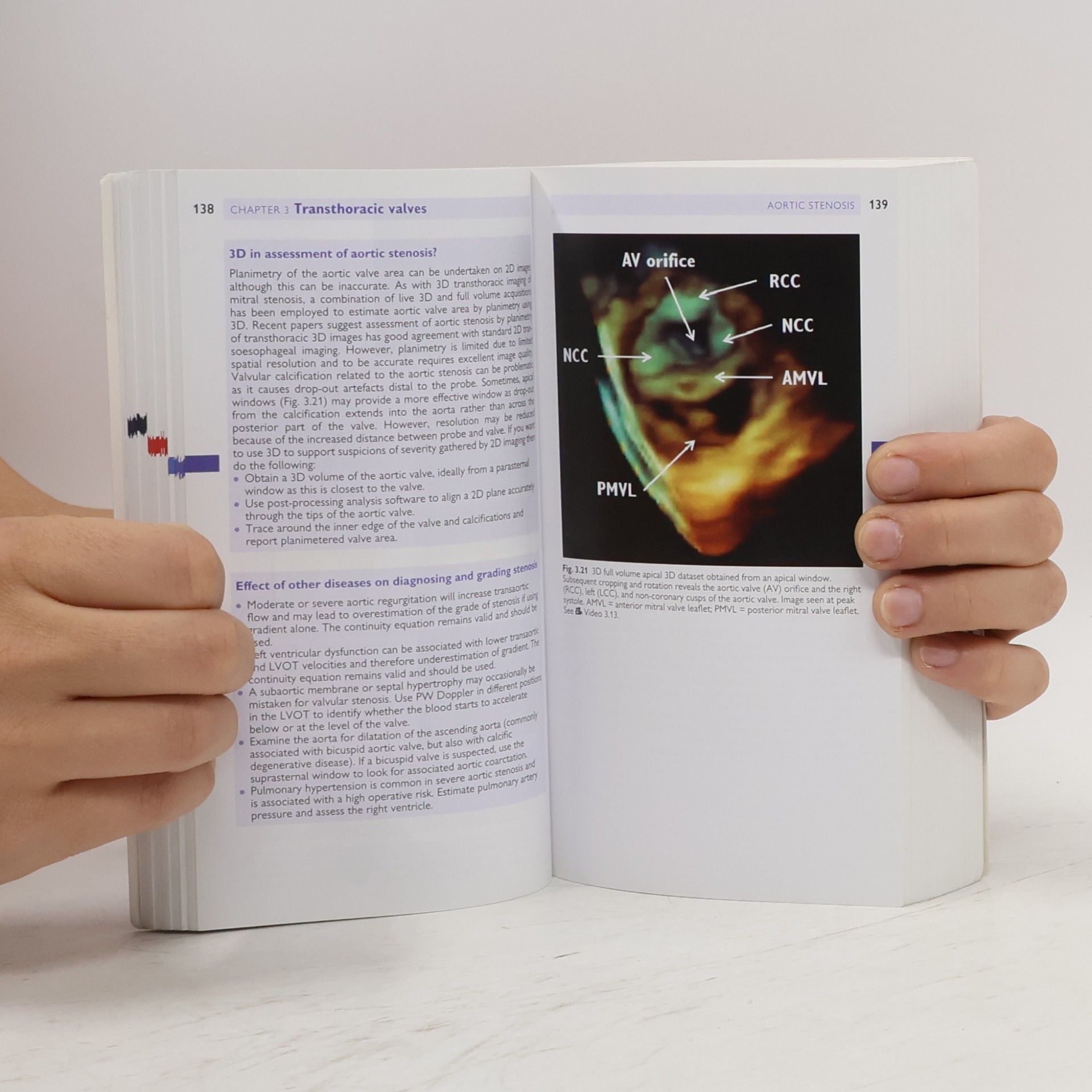 Paul Leeson Oxford Specialist Handbooks in Cardiology: Echocardiography
