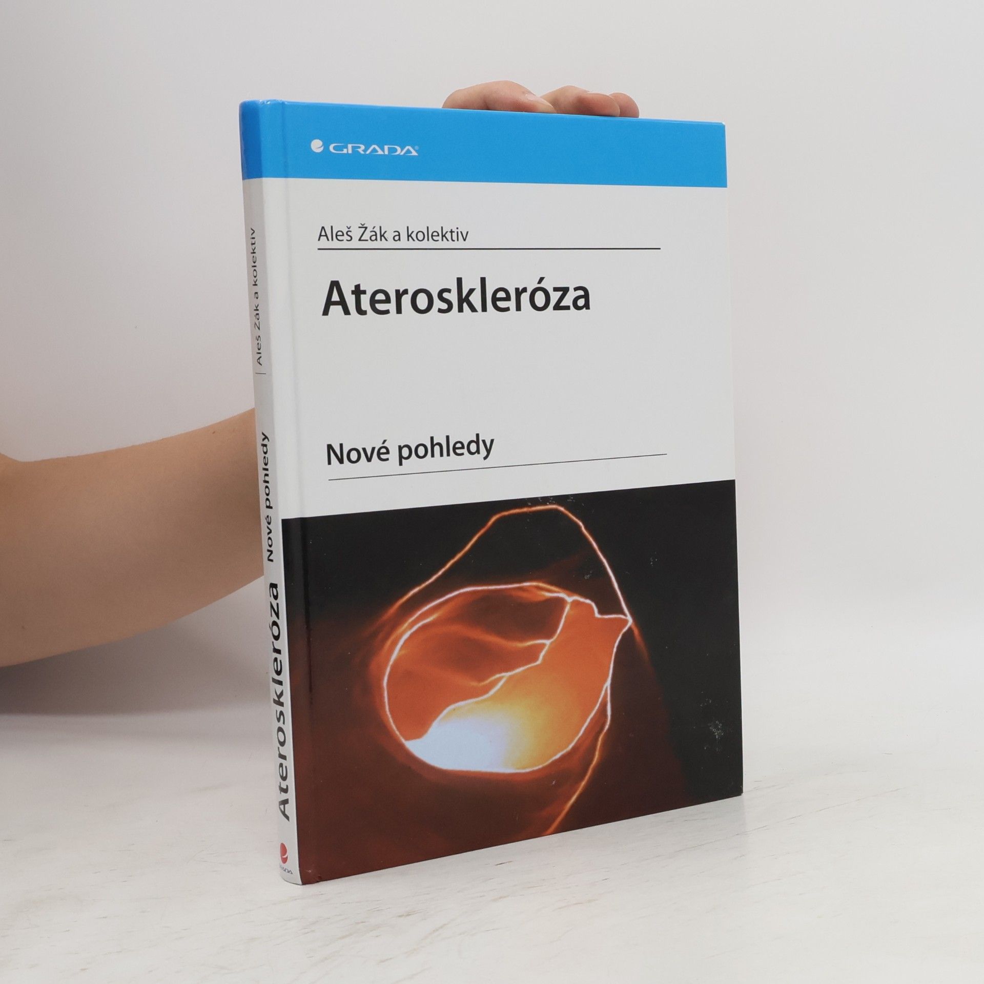 Aleš Žák Ateroskleróza - Nové pohledy