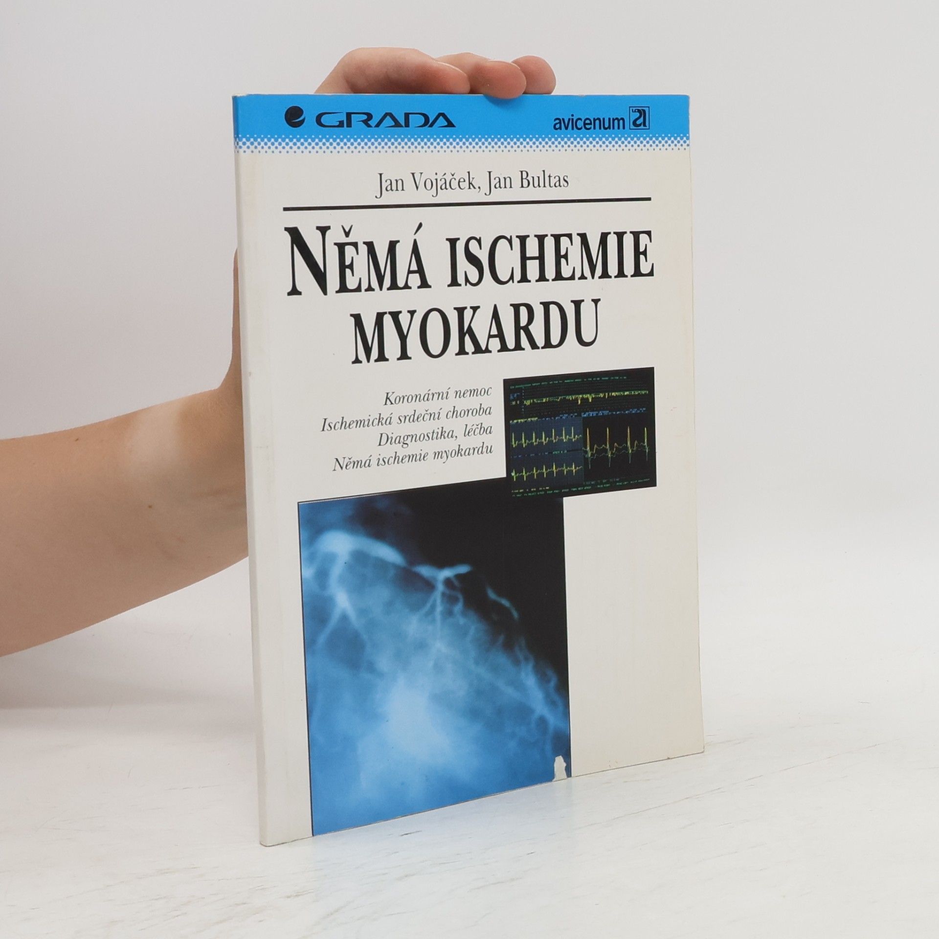 Jan Bultas Němá ischemie myokardu