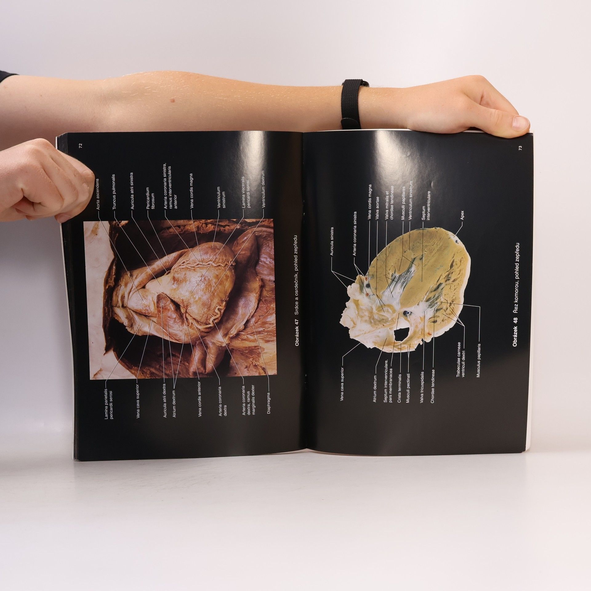 Tom Hutchinson Lidské tělo : obrazový atlas latinsko-česko-anglický