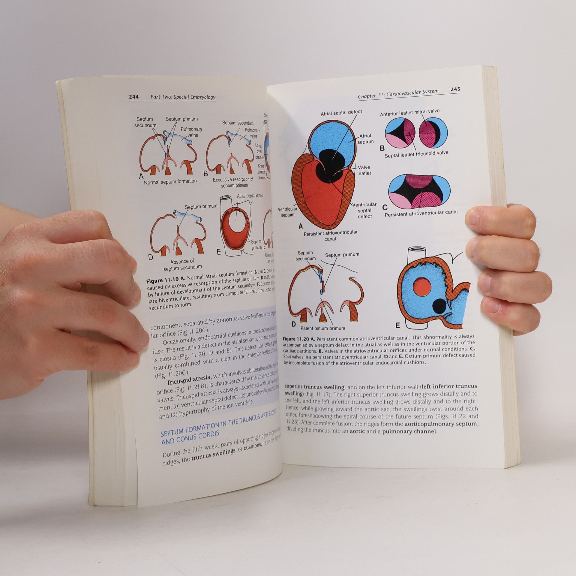 Thomas W. Sadler Langman's Medical Embryology
