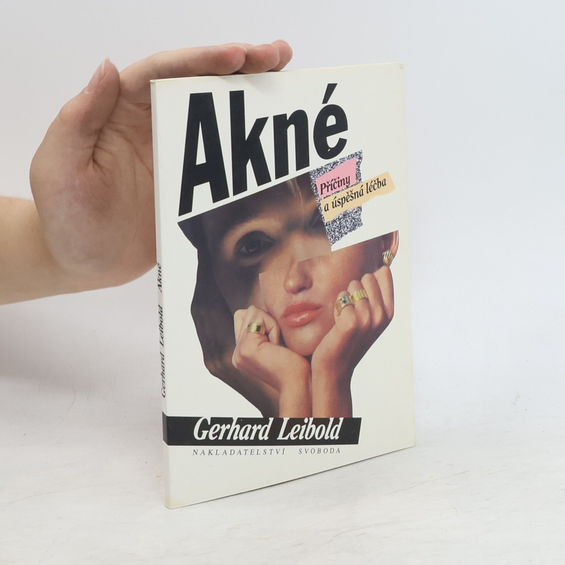 Akné : příčiny a úspěšná léčba