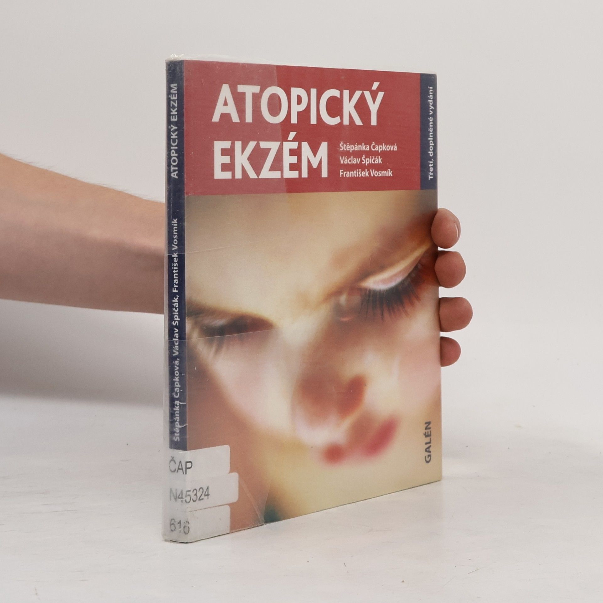 Štěpánka Čapková Atopický ekzém